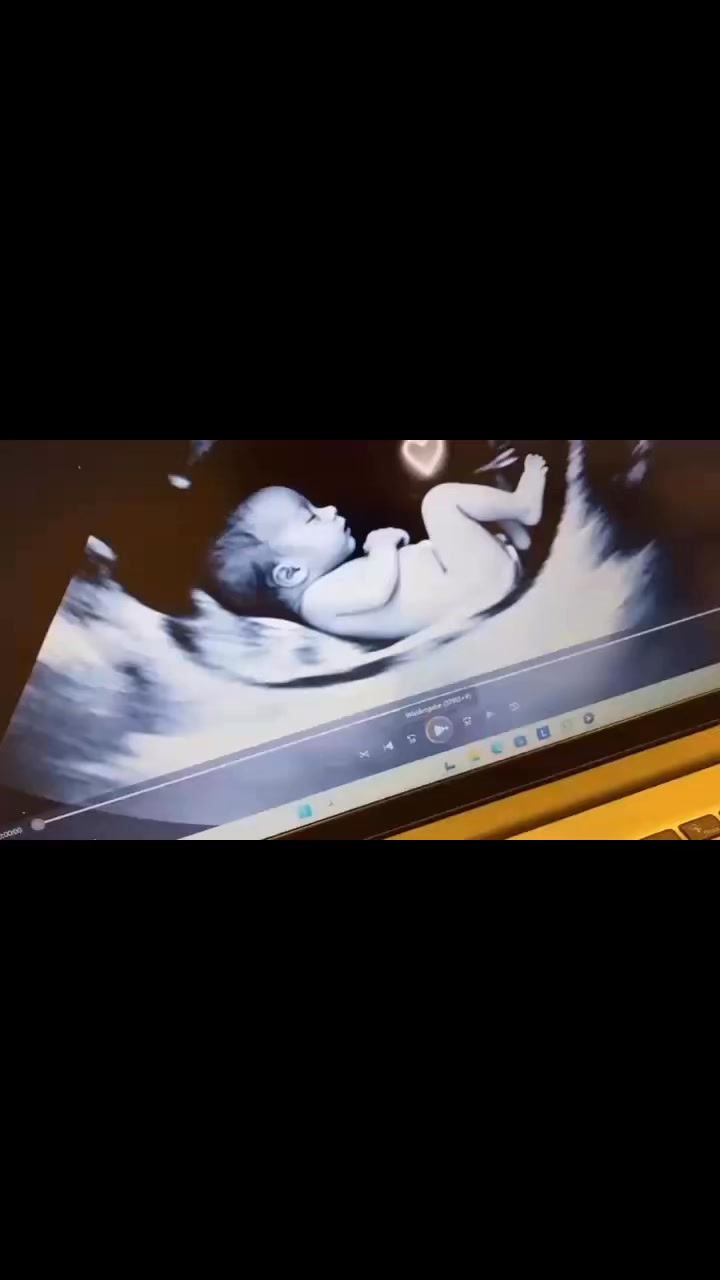 Na wer hat ihn bereits gesehen? Diese Woche läuft er noch 🥰 Ein emotionaler Höhepunkt💖 Ich bin stolz und freue mich euch im Babyhaus Dessau beraten zu dürfen und freue mich auf euren Besuch 🥰 #babyhausdessau #ProSieben #sateins #familienzeit #elternindessau #localkaufen #dessauroßlau #liebefürfamilien #Familienmoment #babyprodukte #kabel1 #joyn