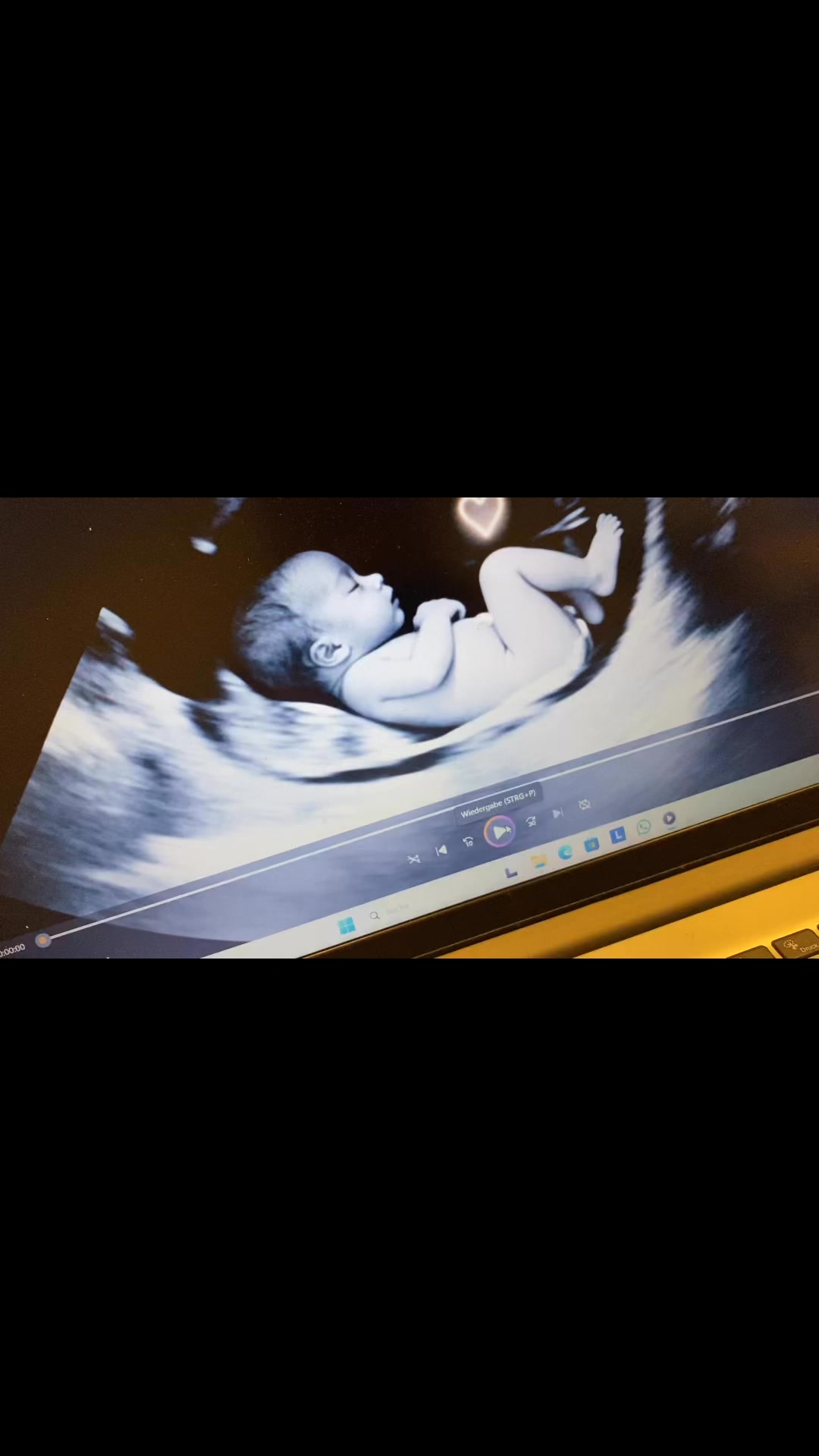 Na wer hat ihn bereits gesehen?
Diese Woche läuft er noch 🥰
Ein emotionaler Höhepunkt💖
Ich bin stolz und freue mich euch im Babyhaus Dessau beraten zu dürfen und freue mich auf euren Besuch 🥰 #babyhausdessau #ProSieben #sateins #familienzeit #elternindessau #localkaufen #dessauroßlau #liebefürfamilien #Familienmoment #babyprodukte #kabel1 #joyn