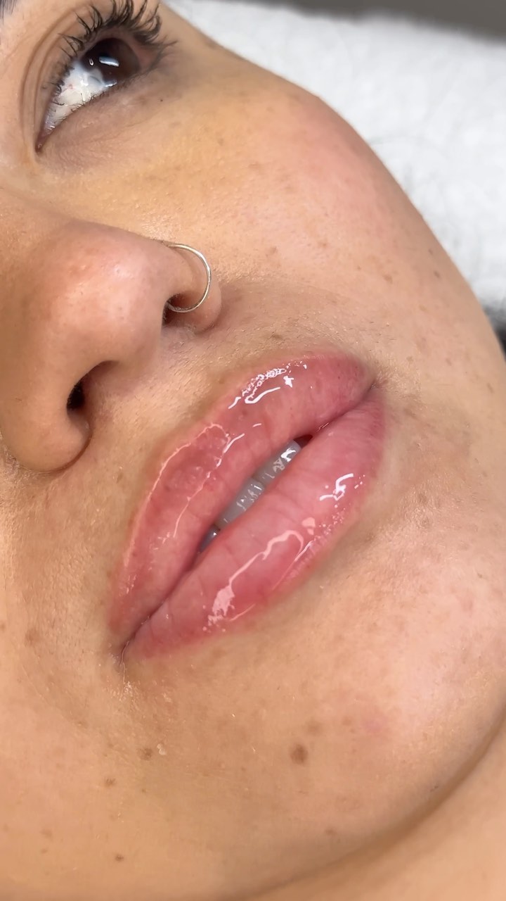 Do you have very dry and dehydrated lips? But too scared of lip filler! Or would you like natural plump lips?
Facts: Microneedling creates tissue that is dense in collagen, which makes your lips fuller. This can give your lips a pouty look with continued use.
Using a microneedling tool followed by a great lip serum can significantly increase moisture levels and promote overall lip health.
Price: £120
📧 info@ladyjolondon.com
📞 020 3417 6778
📍Knightsbridge
🗓️Book via - www.ladyjolondon.co.uk
#microneedling #beauty #courses #beautycourses #salon #knightsbridge