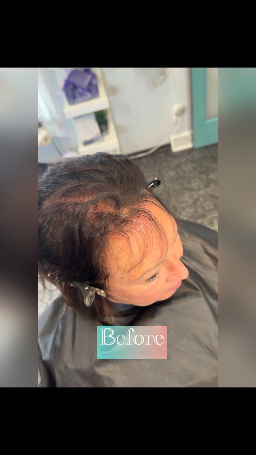 I am dedicated to perfecting the art of the "invisible" topper installation. To help me improve my timing and build my portfolio, I’m offering a discounted rate for new models.
You’ll receive a full consultation, custom fitting, maintenance and styling. My goal is to find clients who love their results so much they become a permanent part of my hair family!
The Details: Only 2 spots remain for February. Applicants must have fine or thinning hair on the top or crown.
Comment “Transform” and I’ll send you my model application.