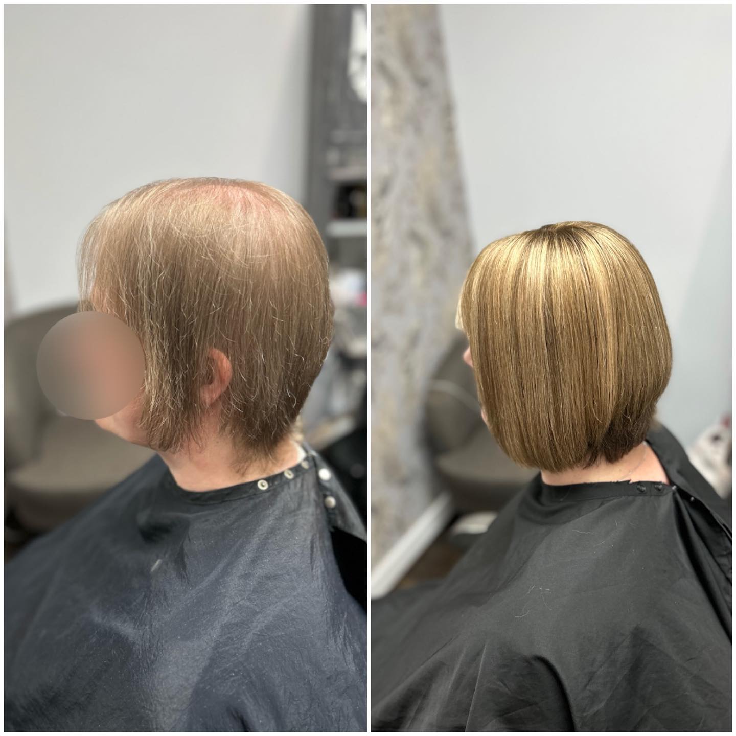 Before & After Lace Integration. I will see this lady again in 5 weeks for her maintenance/ checkup appointment. .
.
.
.
.
.
#lacetopwigs #lacefrontwigs #lacewigs #wigs #lacefrontal #alopecia #areata #hairloss #hairreplacements #bespokewigs #customcolouredwigs #handmadewigs #wigbuilding #hairintegration #laceintegration #hairextensions #weave #hairlossspecialist #trichologist #trichology #hairlosssolution #hairlosssalon #hair