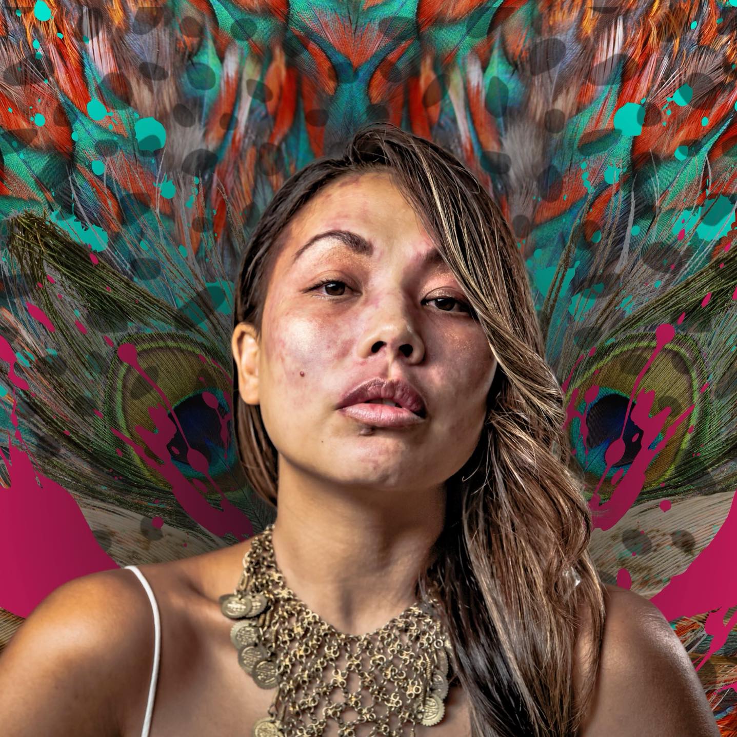 In nature we deem color variety as unique and rare. As a society we see color as a divisive trait to separate us from one another. I think it is time we rethink how we live and interact with each other. Live life in color and be blind to how it separates us. #portwinestain #birthmarkpride #pws #birthmarksupportgroup #lifeincolor #colorblind