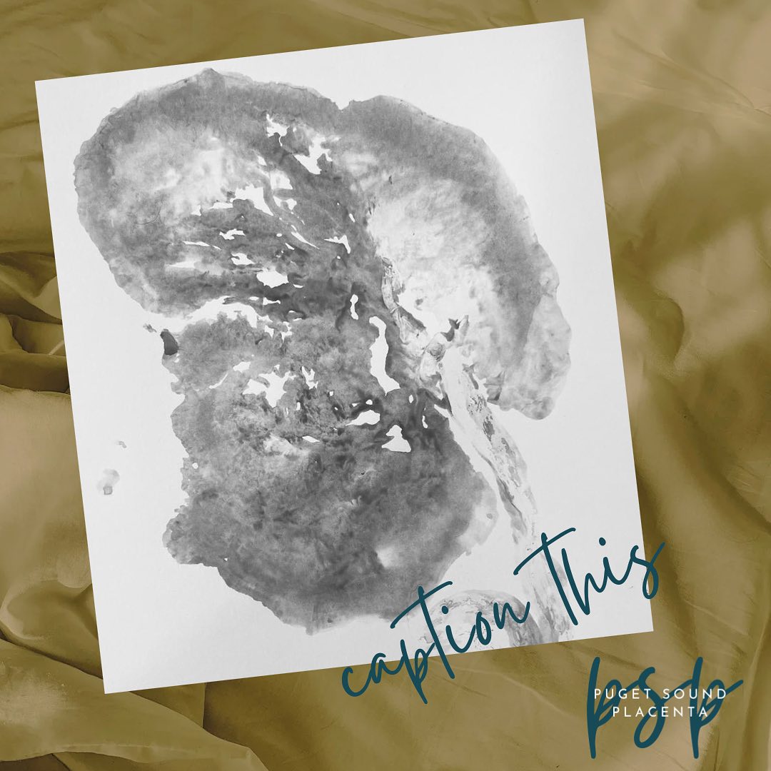 We’ve always thought placentas are pretty magical! And sometimes these prints are just ‘WHOA!’
What do YOU see when you look at this?
#placentaart #placentaencapsulation #placentalove #placentaencapsulation #postpartumlife #pugetsoundplacenta #seattleplacenta #welcometothe4thtrimester