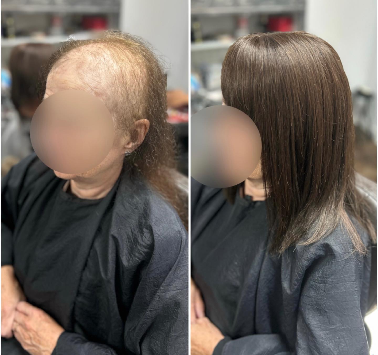 Lace Integration Before & After. This lady had a new system fitted today, her old one lasted over 3 years. I used a mixture of attachment methods, beads and PU patches. I’ll see her again soon for her maintenance appointment .
.
.
.
.
.
#lacetopwigs #lacefrontwigs #lacewigs #wigs #lacefrontal #alopecia #areata #hairloss #hairreplacements #bespokewigs #customcolouredwigs #handmadewigs #wigbuilding #hairintegration #laceintegration #hairextensions #weave #hairlossspecialist #trichologist #trichology #hairlosssolution #hairlosssalon #hair
