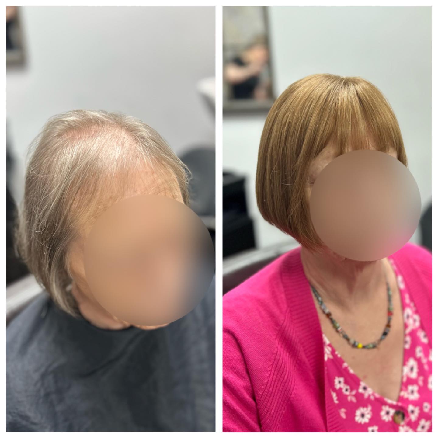 A new system for this lady today. This is her first system, she came in with worries and a little anxious about taking the big step of having a system and left feeling great and full of confidence ❤️ .
.
.
.
.
#lacetopwigs #lacefrontwigs #lacewigs #wigs #lacefrontal #alopecia #areata #hairloss #hairreplacements #bespokewigs #customcolouredwigs #handmadewigs #wigbuilding #hairintegration #laceintegration #hairextensions #weave #hairlossspecialist #trichologist #trichology #hairlosssolution #hairlosssalon #hair