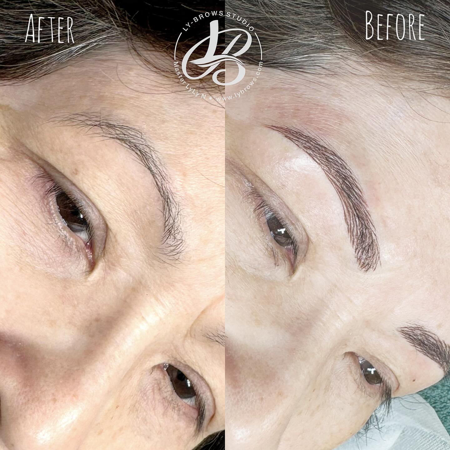 Microblading is a manual skill of semi-permanent eyebrow drawing. Strokes are always drawn in the direction of natural hair growth, and with the same color as natural is, to achieve hyper-realistic look.
Procedure is performed with a disposable sterile tool and pigments are produced in accordance with the highest standards. After the treatment, color is around 30-50% darker and eyebrows are around 10% thicker. Correction is done 4-6 weeks after the initial treatment, because between 10-15% of drawn strokes disappear after the first treatment.
Your aftercare in a first 7 days makes 80% of the treatments success.
Color duration primarily depends of how oily the skin is. The oiler the skin, the shorter the color lasts. On average, expected time until a new color refreshment is between 8-15 months.
Pain during the treatment is relative. Scared clients usually feel stronger pain, while the other clients compare such pain with the one that they feel when plucking out their eyebrows. In addition, with women having period there is an increased sensitivity to pain, so it is recommended to avoid doing procedure while ladies have their period (if possible).
Abrasive treatments such as peelings, fruit acids, chemical peels, laser treatments and similar should be avoided a month before the treatment. Also, one month before the treatment, botox or fillers should not be used..
.
#microbladingbrows #lybrows #lybrowstudio #pmubrows #pmuartist #hairstrokeseyebrows #northernvirginia #restonva #herndonva #