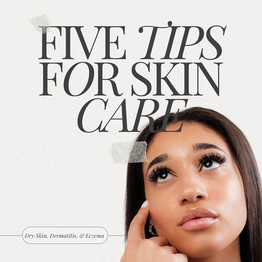 Unlock the secrets to glowing skin with these five skincare tips for people struggling with dry, sensitive skin! From nourishing with antioxidants to embracing consistency, these simple steps pave the way to a radiant, glowy complexion ✨🌱
#butterflyhigh #cbdskincare #cbdserum #cannabinoids #dermatitis #eczema #dryskin #essentials #skincare #naturalingredients #vegan