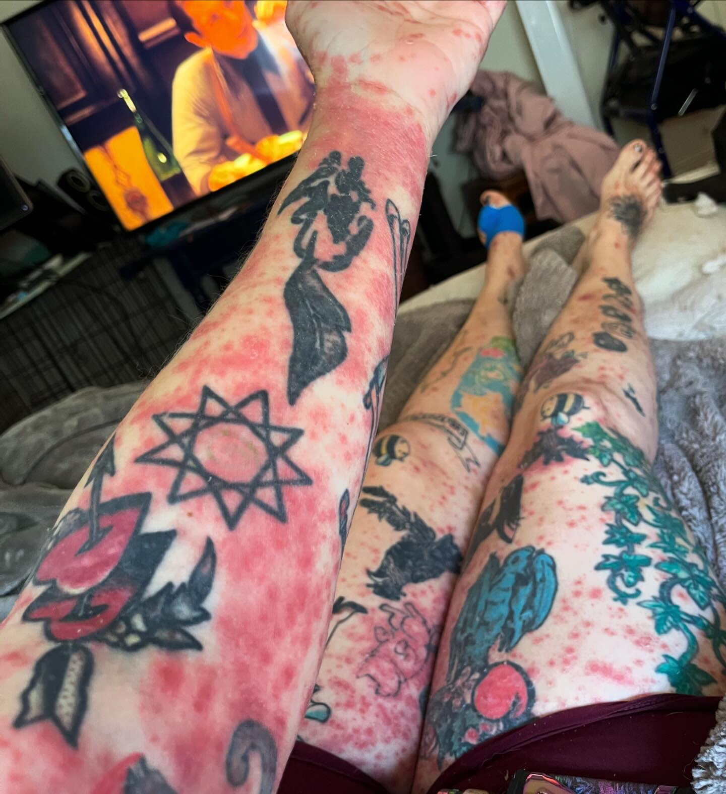 It gets worse before it gets better :(