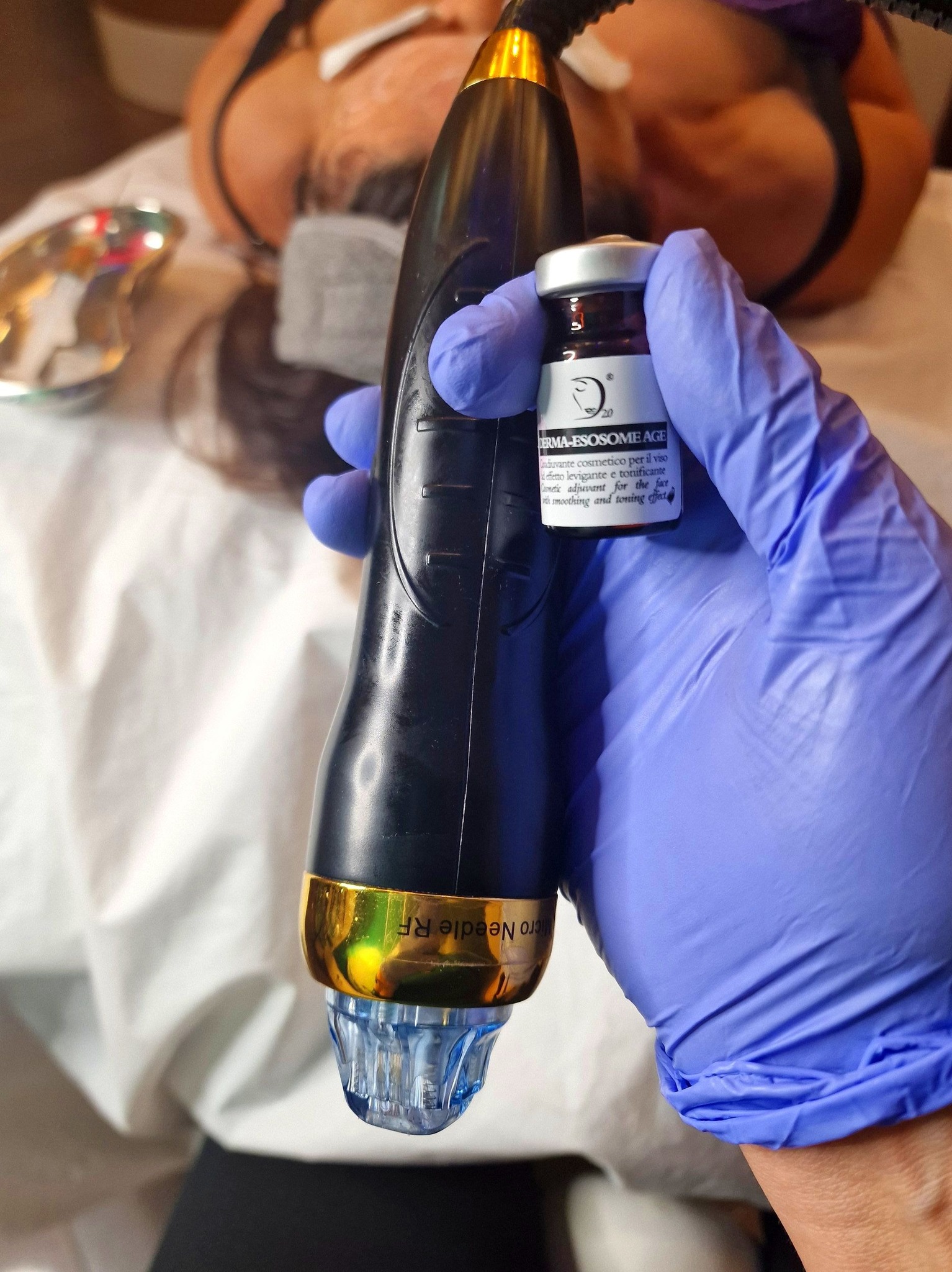 📍📍NEW TREATMENT 📍📍
Exosomes combined with Radio Frequency Micronnedling
What are the Exosomes ?.
🚨Exosomes play an important role in the body by transporting proteins, lipids and nucleic acids and carrying biological information into cells. They have numerous functions in the body, including a key role in the processes of tissue regeneration and cell proliferation.
🚨Exosomes have the ability to penetrate deep into the skin and support intensive regeneration and rejuvenation of the skin without the need for injections. Thanks to their unique properties, the skin becomes regenerated, brightened and tense. They also act as antioxidants, counteracting harmful oxidative stress, which accelerates cell aging.
The use of Exoxe stimulates the production of collagen and elastin, strengthening the skin and increasing the production of extracellular matrix components.