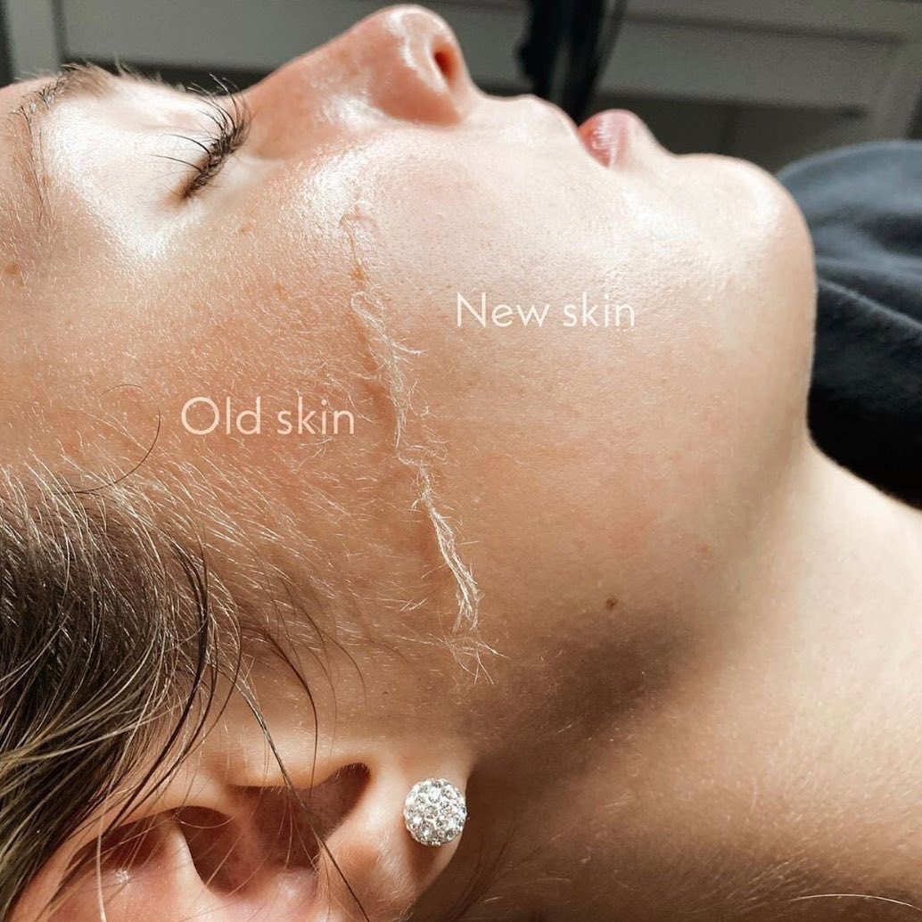 ✨ Say goodbye to dull skin and hello to a radiant glow with dermaplaning! ✨ Our skilled esthetician @mayabeautyesthetics will gently remove dead skin cells and peach fuzz, leaving your skin smoother, brighter, and ready to absorb all the skincare goodness. Add this service on to any facial or try as a stand alone treatment to experience the magic of dermaplaning today and unveil your skin's true beauty. 💆♀️✨
.
Book online with Maya, link in bio.
.
#Dermaplaning #GlowingSkin #BeautySecrets #folsomsalon