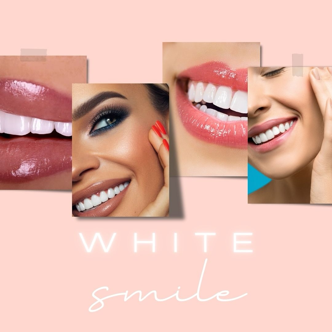 There is no grater feeling of confidence, than a whitened smile. If you don’t believe me, try it for yourself.
With a one hour session removing years of stains, to achieve up to 14 shades whiter teeth, it will be hard to wipe the smile from your face.
A dazzling smile is the perfect accessory for any big event or just a pick me up for an instant confidence booster.
What are you waiting for? Book now!
#TeethWhitening #WhiteSmile #ConfidenceBoost #PearlyWhites #BeHappy #SayCheese #WeddingPrep #Smile #Wollongong #Illawarra #LaBelleSkinTherapy