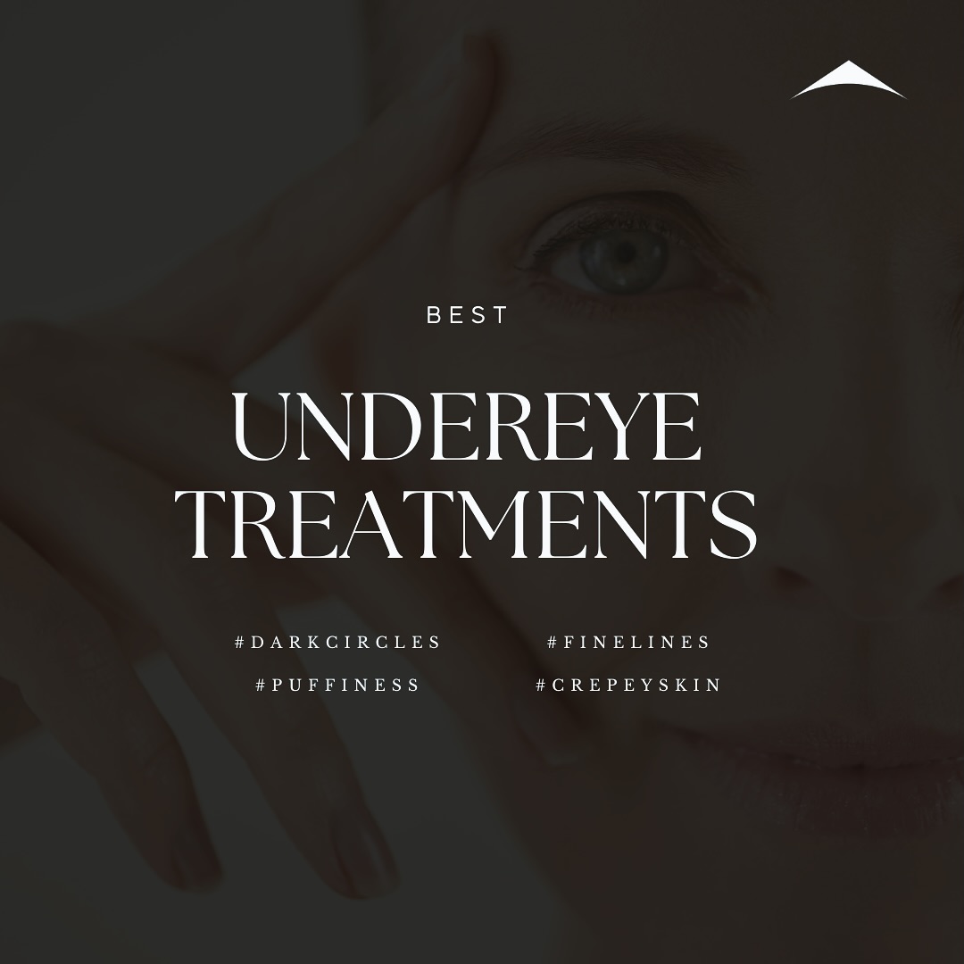 The delicate skin under the eyes is often one of the first areas to show signs of ageing, such as fine lines, wrinkles, dark circles, and puffiness. Among the most popular and effective treatments are Thermage FLX, Polynucleotides, and anti-wrinkle injections. Each of these treatments offers unique benefits, catering to different needs and preferences.
1. Thermage FLX: Non-Surgical Skin Tightening
Thermage FLX is a non-invasive radiofrequency treatment designed to tighten and contour the skin by stimulating collagen production. This procedure is particularly effective for the undereye area, where skin tends to sag and develop fine lines.
How It Works: Thermage FLX uses radiofrequency energy to heat the deeper layers of the skin. This heat stimulates the production of new collagen and tightens existing collagen fibres, leading to firmer, smoother skin over time.
2. Polynucleotides: Cellular Regeneration and Repair
Polynucleotides, derived from salmon DNA, are gaining popularity for their regenerative and reparative properties. They are used in mesotherapy injections to revitalise and rejuvenate the skin by promoting cellular regeneration and repair.
How It Works: Polynucleotides are injected into the skin, where they stimulate fibroblasts and other cells to produce collagen and extracellular matrix components. This enhances the skin’s natural repair processes and improves elasticity and hydration.
3. Anti-Wrinkle Injections: Quick and Effective
Anti-wrinkle injections are a well-known treatment for reducing the appearance of fine lines and wrinkles. They work by temporarily relaxing the muscles that cause wrinkles, resulting in smoother, younger-looking skin.
How It Works: Botulinum toxin is injected into specific facial muscles, blocking nerve signals and preventing muscle contractions. This relaxation of the muscles smooths out wrinkles and prevents new ones from forming.
Always consult with a qualified aesthetic practitioner can help determine the best treatment plan for your specific concerns, ensuring you achieve the best possible results for a youthful, rejuvenated appearance.
#ThermageFLX #polynucleotides #undereye #antiaging #botox #montecosmet