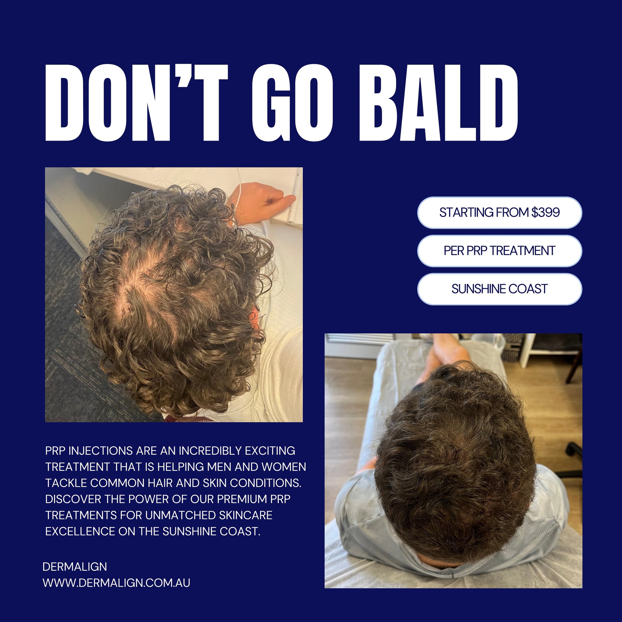 PRP hair restoration appointments starting at $399. Bookings available now!