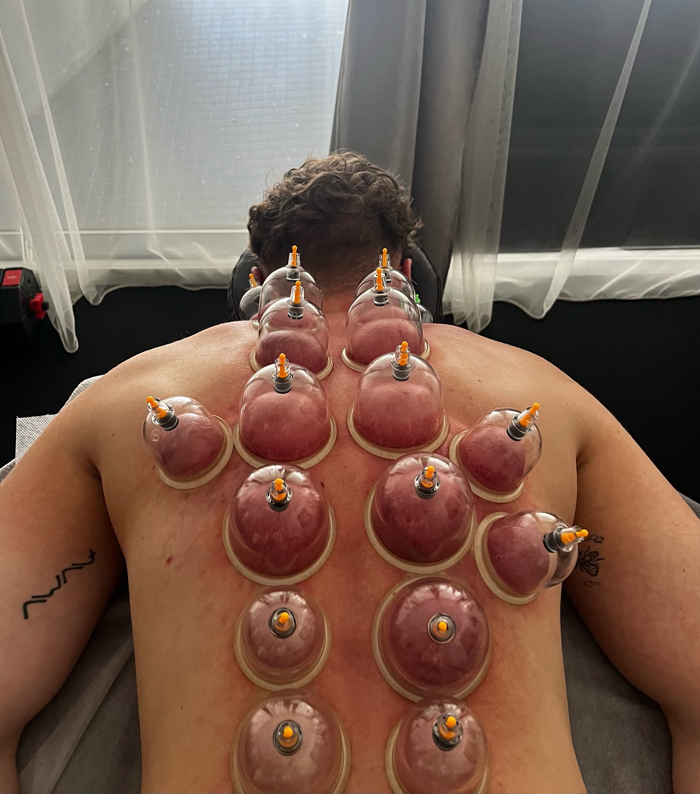 💮Vakuuminių taurių terapija.
🎈Fizinė ir psichologinė atgaiva (ištraukia įtampą ne tik iš kūno, bet ir iš minčių) arba, kaip jūs sakot “maloniai apsvaigęs”🌝
Taurės siurbimas naudojamas kraujui patraukti į konkrečias kūno vietas arba iš jų. Tai dažniausiai naudojama, kad palengvintų būklę, sukeliančią skausmą, nes taurės pritraukia naujo kraujo ir mineralinių medžiagų į vietą, kur jaučiamas diskomfortas ir palengvina įtampą.
Tai taip pat padeda esant lėtinėms (nuolatinėms) sveikatos problemoms tokioms kaip:
📍nugaros, kaklo, pečių skausmui, artritui, asmai, galvos skausmams