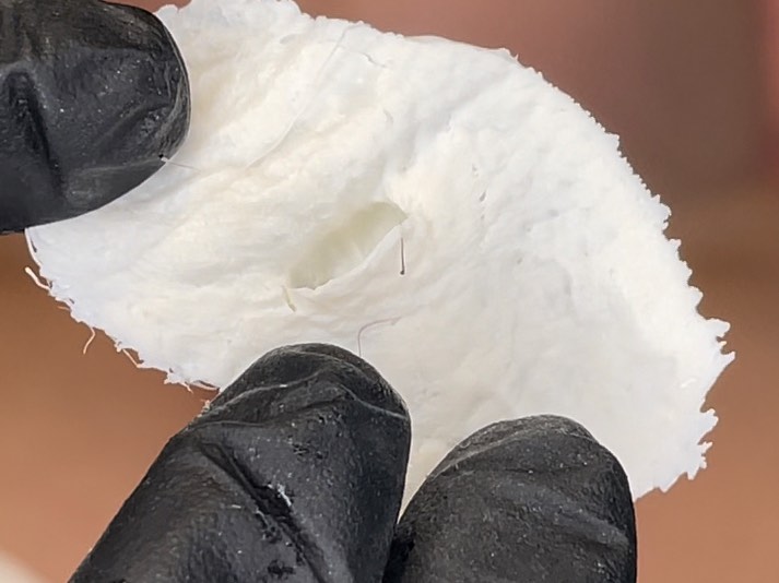 CAN IT?
Can your wax technician do this? What the heck is this anyway?
This is a moulding of a raised mole. The wax we use is flexible and mouldable to the anatomy and to beauty marks. We know there are hairs trapped and many waxes on the market aren’t safe to do something like this.
With Caronlab waxes, we can safely do this and know which waxes are best to protect the skin and avoid complications.
Schedule your wax in with us and experience a Waxperience! We wax differently - we wax the Caronlab way!
#yyc #yycnow #yycbusiness #yyclocal #calgarybeauty #yycspa #yycsalon #yycfacials #yycbrows #yycstylist #yycshopping #calgarysmallbusiness #yycbeauty #yycesthetics #yycfacial #calgaryhairstylist #yychair #yycsmallbiz #yycsmallbusiness #yycgirls #yycbalayage #yycskincare #calgary #yyclocal #yychomebasedbusiness #yychomebasedsalon #yychomebasedesthetics #yycwaxing #yycmen #yycskin