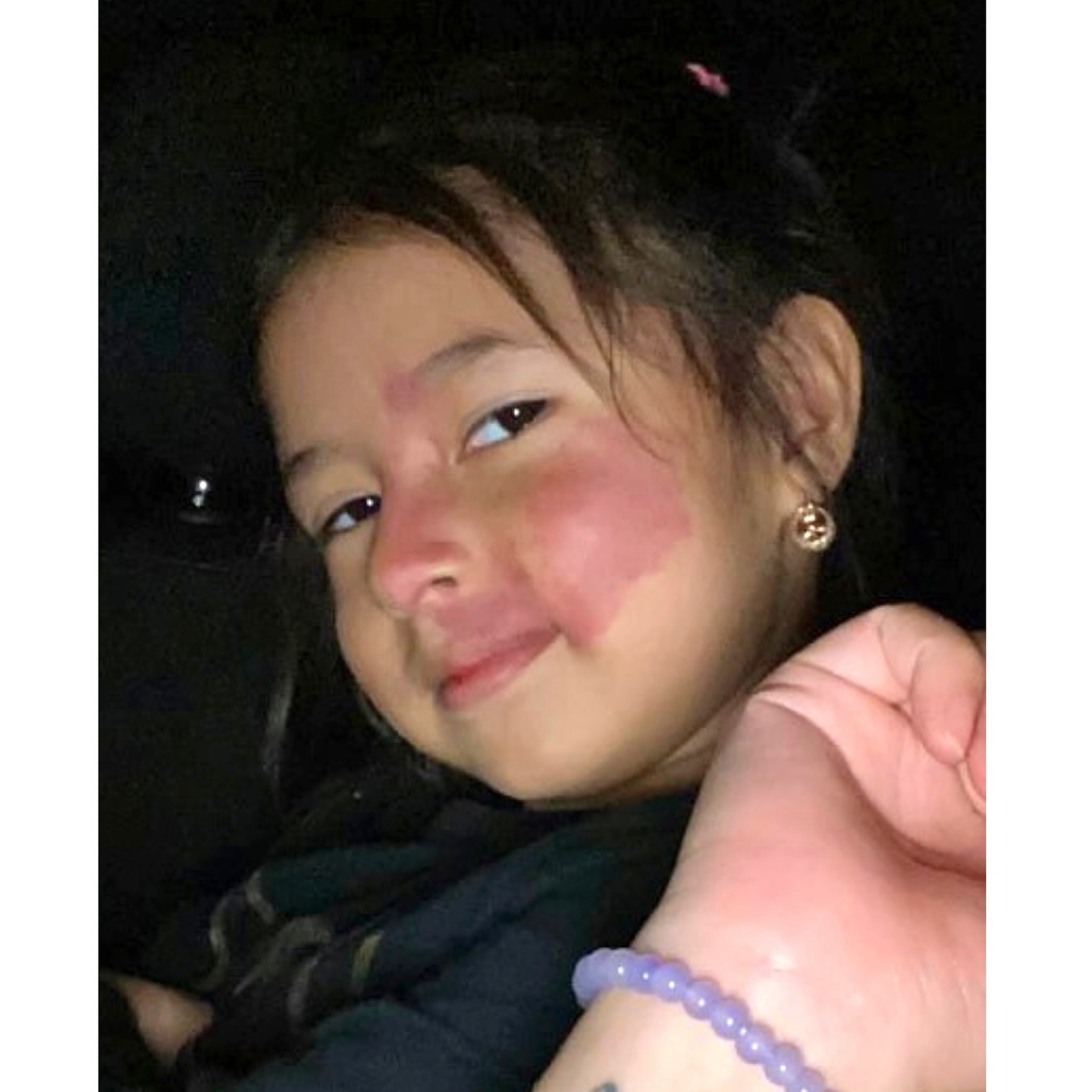 Miss Airana and her beautiful birthmark are in the #spotlight today! Isn’t she a beauty!🩷
.
.
.
.
.
.
.
.
.
.
.
.
.
**thank you , Laura, for sharing💞
#birthmarkbeauty #portwinestain #birthmark #visibledifference #BeautifulAsIam #pws #birthmarkcommunity #BBfamily