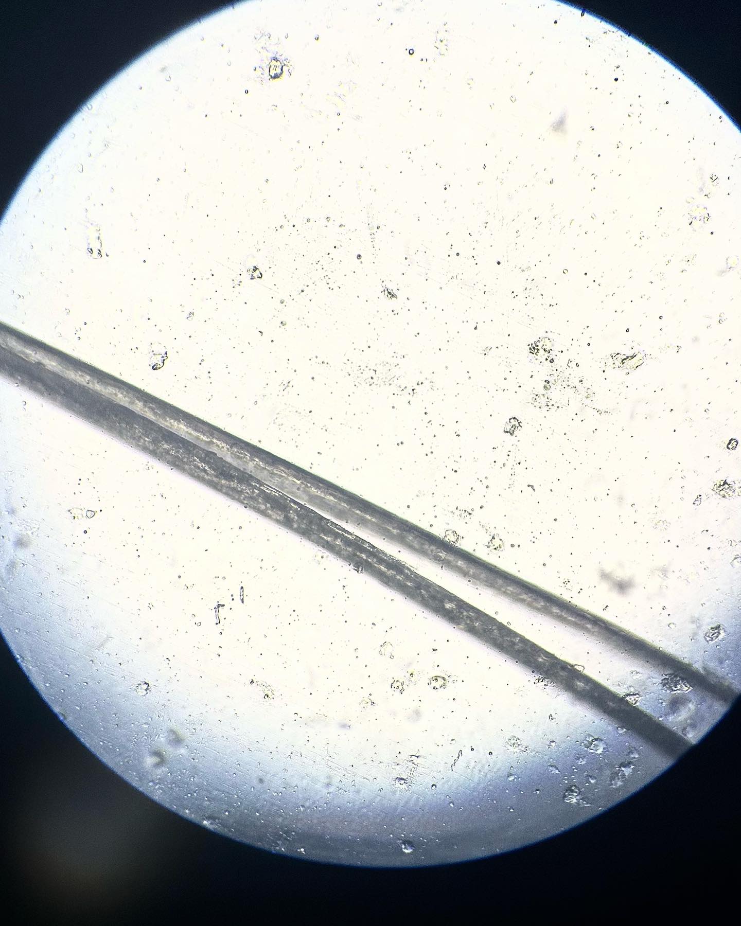 The importance of a hair cut. ✂️✂️✂️
Getting a regular hair cut will help you grow your hair long and healthily. If you avoid the scissors your hair will still grow BUT it will split and weather at the other end. .Here’s close up images from under the microscope of a weathered split end 🔬
.
.
.
.
.
#lacetopwigs #lacefrontwigs #lacewigs #wigs #lacefrontal #alopecia #areata #hairloss #hairreplacements #bespokewigs #customcolouredwigs #handmadewigs #wigbuilding #hairintegration #laceintegration #hairextensions #weave #hairlossspecialist #trichologist #trichology #hairlosssolution #hairlosssalon #hair