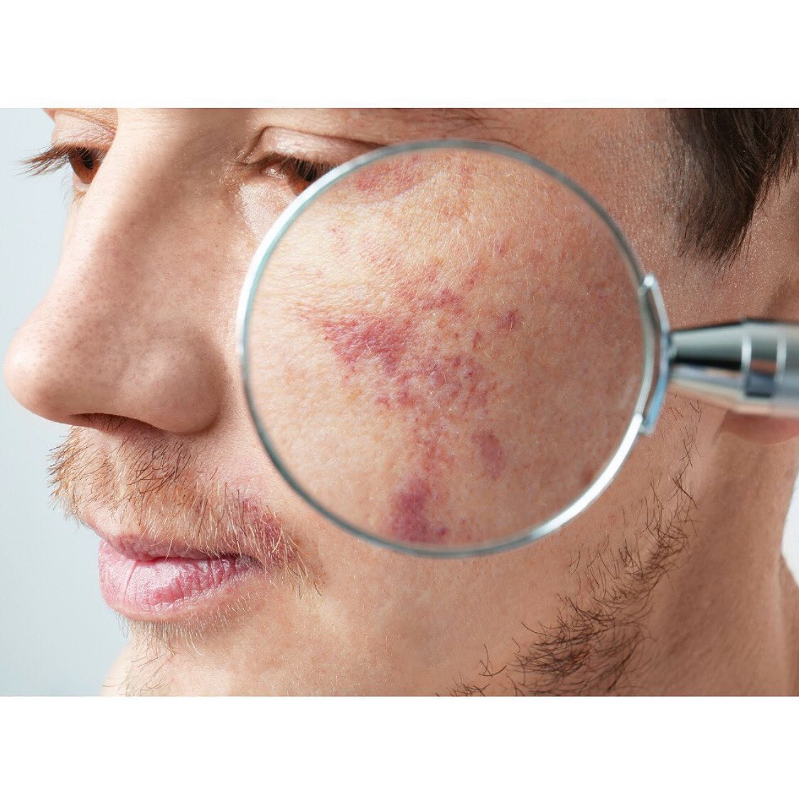 Isn’t this how so many of us feel? Like whenever we’re in conversation with anyone all they can see is our birthmark, skin condition or scars? Like it’s magnified x10 and anything we say/do is overshadowed by what we believe the other person is focusing on.
⠀⠀⠀⠀⠀⠀⠀⠀⠀
I’ve learned over the years that it’s all about how we carry ourselves. If we ourselves are so focused on our “blemishes” that it consumes our thoughts, that will come across when we interact with others and will most likely have them focusing on the same. But, when we carry a perspective of gratitude and are focused on all the things we’re blessed with and stand boldly in that—THAT’s what will come across when interacting with others. There will be a confidence and security in who we are that will stand out. And no matter who we come in contact with...there will be no denying the light we exude!!!
⠀⠀⠀⠀⠀⠀⠀⠀⠀
We set the tone…shine bright!🌟💫✨💪
.
.
.
.
.
.
.
.
.
—“I am beautifully blemished”
#interactions #birthmark #skincondition #scars #visibledifference #beautifulAsIam #setthetone #selfconfidence #boldness #security #shinebright