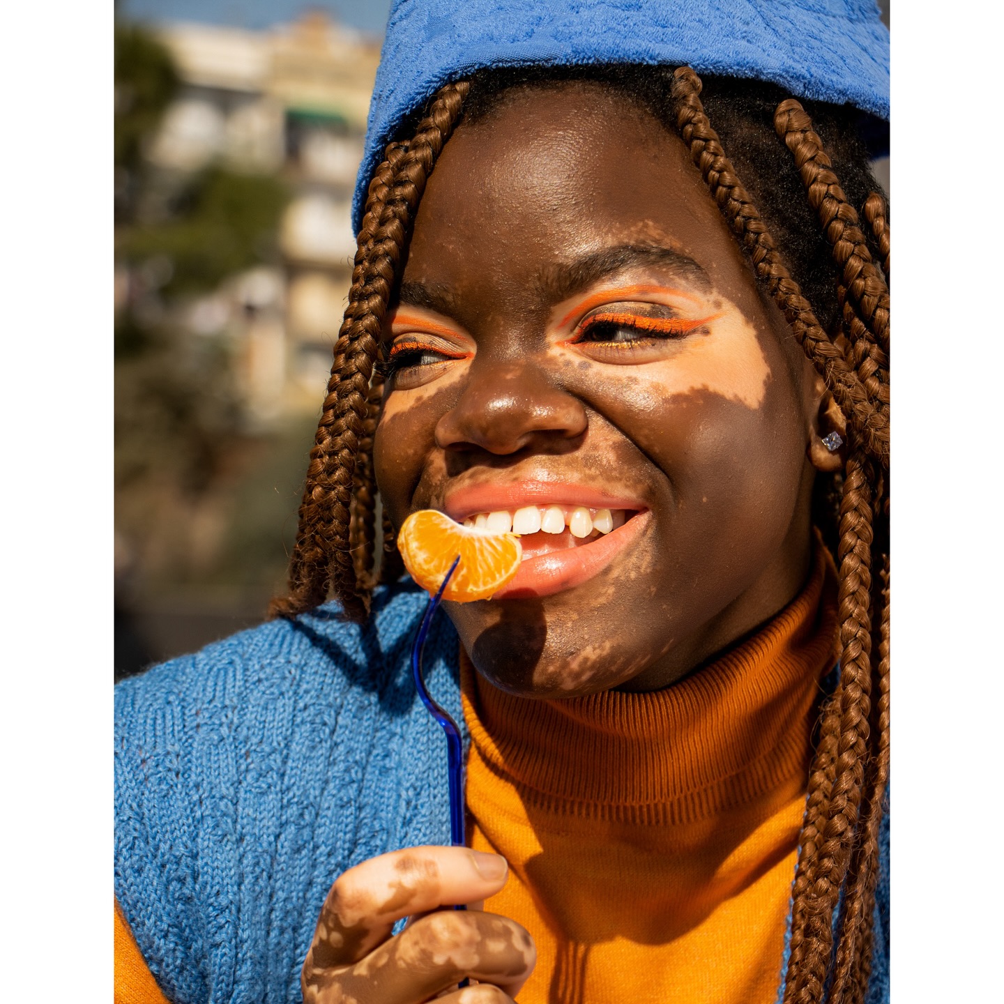 One of our biggest goals here @beautifullyblemished365 is to bring normalcy to visible birthmarks, scars, growths & spots everywhere...
⠀⠀⠀⠀⠀⠀⠀⠀⠀
We’ve all been guilty of gawking at something or someone that looks different from us or from the “norm”. Some stares are filled with malice & cruelty and others with curiosity & concern. There are some who respond (by word or action) to differences with intention to be rude and hurt feelings. And there are other times I believe people respond simply out of ignorance and discomfort. One may see something different, feel uncomfortable and thoughtlessly react.
⠀⠀⠀⠀⠀⠀⠀⠀⠀
Our hope is that by displaying many different types of visible skin conditions, birthmarks and scars there will be less and less “shock factor” and more and more acceptance, normalcy and appreciation for differences.
⠀⠀⠀⠀⠀⠀⠀⠀⠀
Here’s to helping change the narrative and the standard of beauty.🥂
⠀⠀⠀⠀⠀⠀⠀⠀⠀
—“I am beautifully blemished”
.
.
.
.
.
.
.
.
.
#normalizedifferent #visibledifference #birthmark #vitiligo #portwinestain #pws #keloid #moles #spots #scars #rosecea #psoriasis #nevus #hemangioma #eczema #skindifferent #beautymark #unique #selflove #diversity #selfconfidence #skinpositive #bodypositive #beautifulAsIam #normalizebirthmarks #birthmarkcommunity #viticommunity #scarcommunity #keloidcommunity #beautifullyblemished