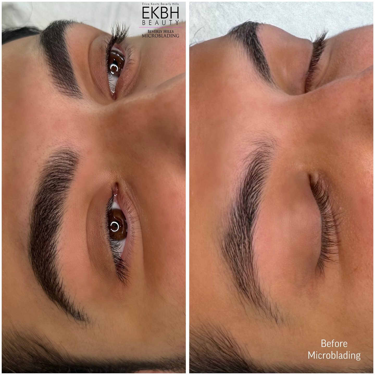“Check out these stunning results after a flawless microblading touch-up! 🌟 Adding more density to his brows while keeping it perfectly natural - masculine brow goals achieved! 💪💫
Who’s next? #MicrobladingMagic #NaturalBrows #mensmicroblading