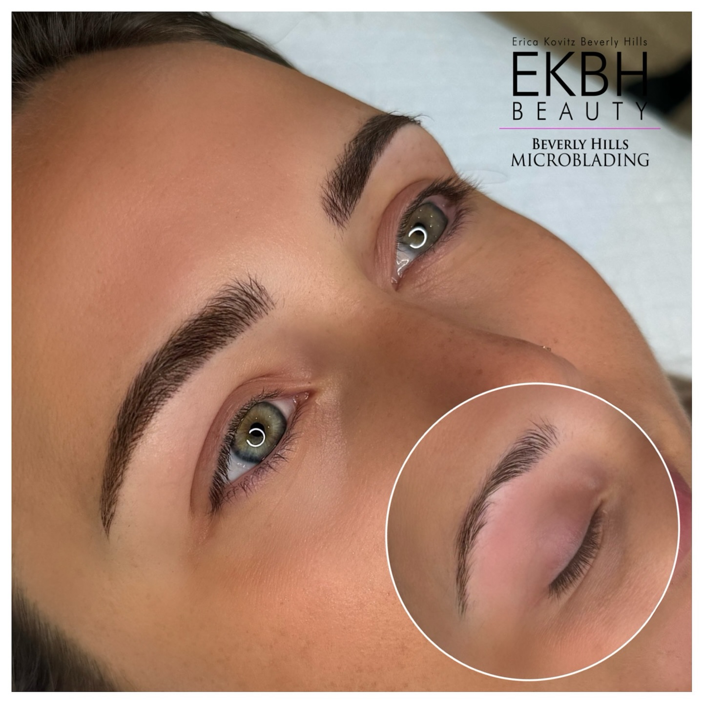 ✨ Stunning brow transformation alert! ✨ This beauty now rocks a 3D Combo that reshapes and fills in those over-plucked areas. Say goodbye to the hassle of filling in your brows every morning and feeling self-conscious during workouts! 🙌
Performed manually by hand with a nano blade—no machines involved! 🌟
🔹 Skin Type: F2
🔹 Color: B1
🔹 Blade: Nano 15mm Classic
🔹 Artist: Erica Kovitz
These gorgeous results can last for years!
Ready to transform your brows? Call or text us at 310-853-0744 to book your appointment! 📞💖