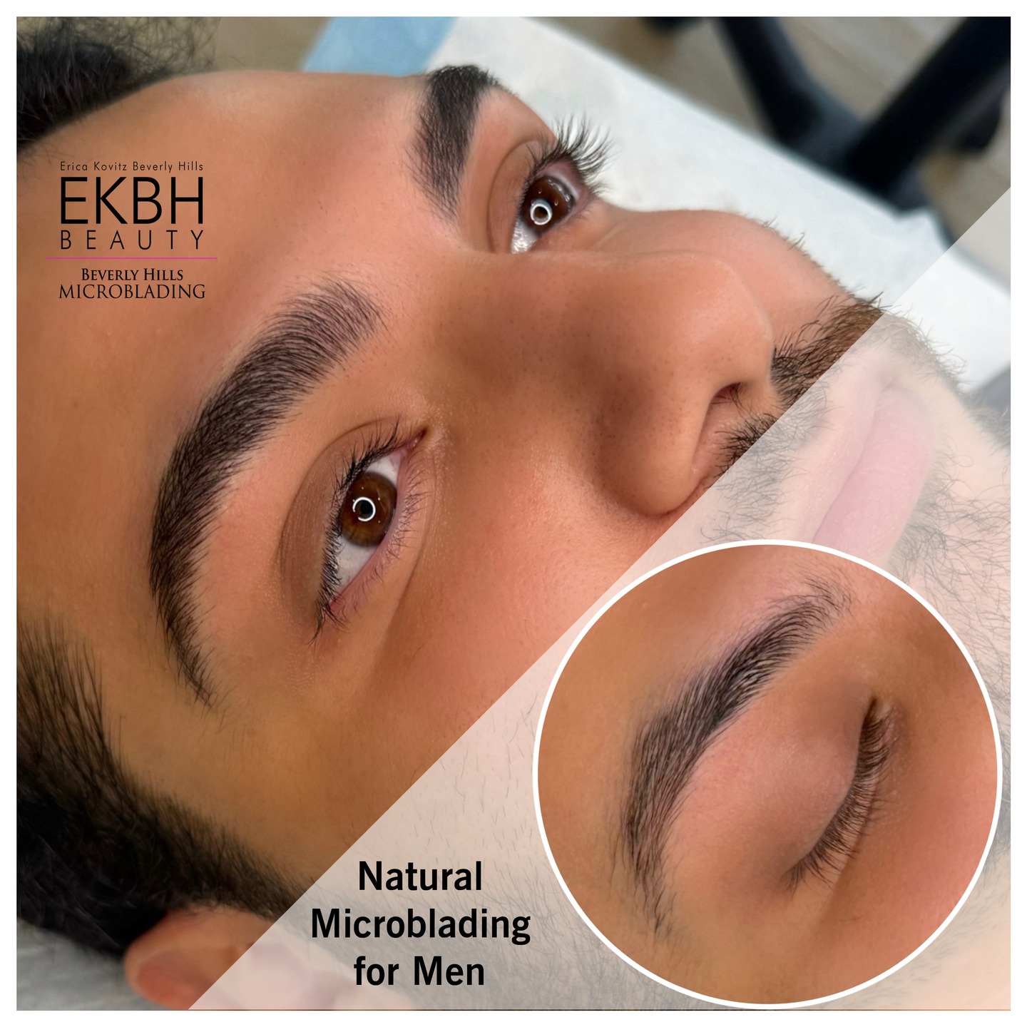 Brow goals achieved all the way from Dubai to Beverly Hills! 🌟 This client’s brows got a boost with natural microblading, creating a fuller, more defined look. Honored to have clients like him traveling to see me for their brow transformations! 💫 Ready to enhance your brows? Reach out at 310-853-0744 or visit BeverlyHillsMicroblading.com to book your appointment. 💖 #BrowTransformation #MicrobladingMagic #DefinedBrows #ericakovitz #beverlyhillsmicroblading #mensmicroblading