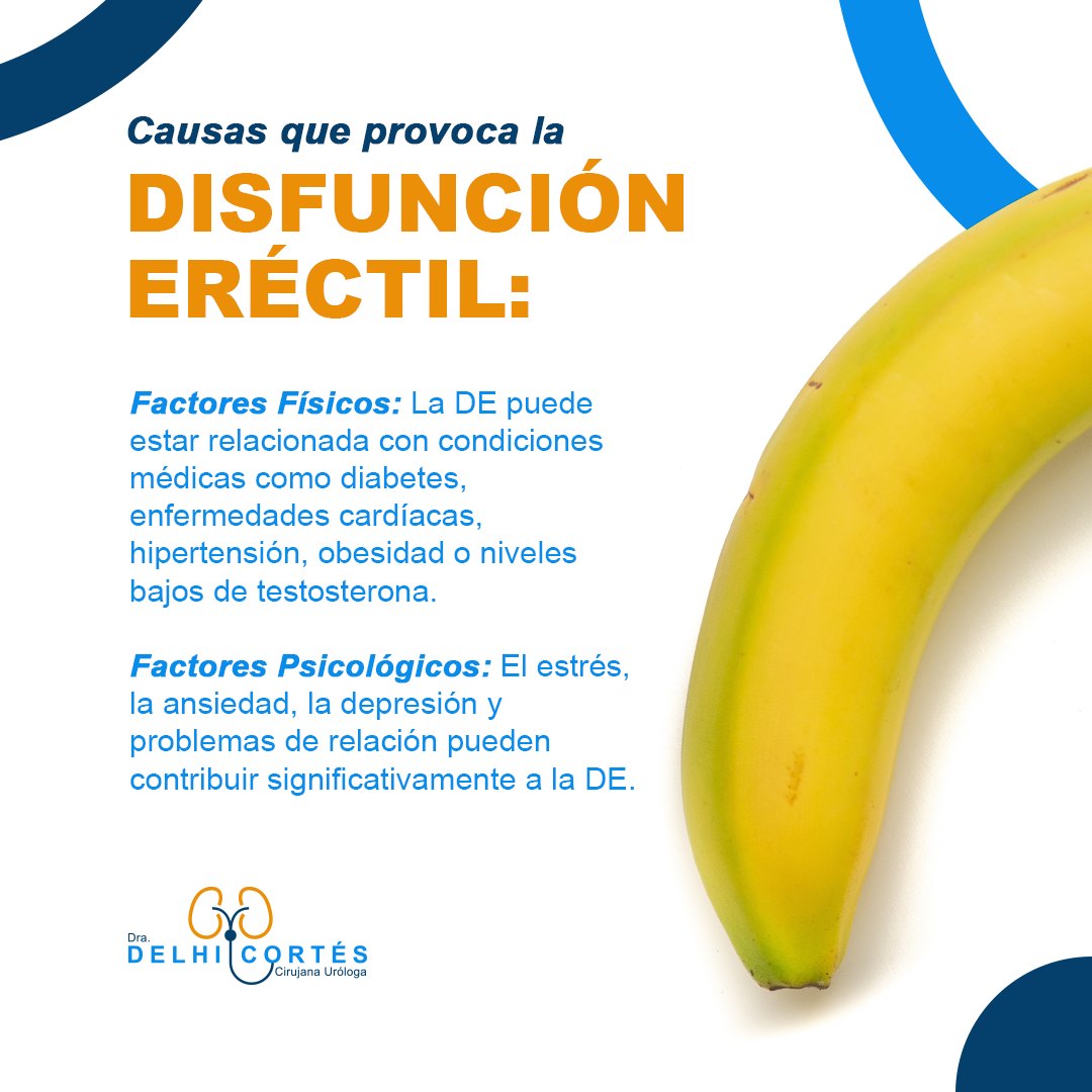 👉La disfunción eréctil (DE) es la incapacidad persistente para obtener y mantener una erección lo suficientemente firme como para tener relaciones sexuales satisfactorias.
👉Es un problema común que puede afectar a hombres de todas las edades, aunque se vuelve más común a medida que los hombres envejecen.
🙌La DE es un problema común y tratable. Es importante buscar ayuda médica y considerar las opciones de tratamiento disponibles para mejorar la calidad de vida sexual y emocional.
Agenda tu cita 👇
⚕️Doctoralia: https://www.doctoralia.com.mx/yeniseik-delhi-cortes-vazquez/urologo/san-andres-cholula
📞 Teléfono: 222 227 2713
✅ WhatsApp: 561 213 3757
Dirección:
📍 Periférico Ecológico 3507, int. 1229, Col. Emiliano Zapata, San Andrés Cholula
Horarios:
🕗Martes y jueves de 16:00 a 20:00 hrs
🕗Sábados de 10:00 a 14:00 hrs
👩⚕️ Dra. Delhi Cortés
Médico general, C.P. 09137489
Especialidad en urología, C.P. 12342044
Certificación del consejo Mexicano de Urología, 1787
#urología #urologo #médicourologo #urologa #urologocholula #urologacholula #médicocholula #urologoTlaxcala #Puebla #Tlaxcala #Cholula