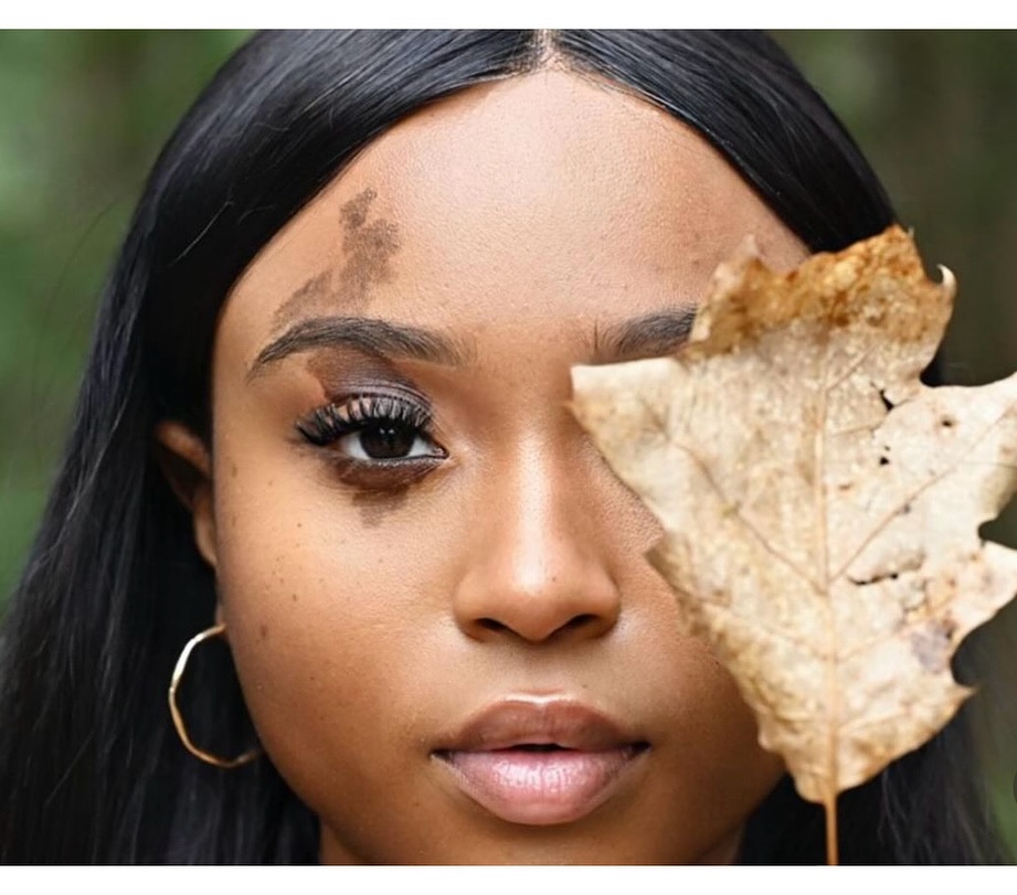The gorgeous, Deja, has the #spotlight today…showing off her beautiful birthmark with these 🔥🔥🔥 closeups!🤩
Thank you @remarkable.dej for sharing💞
#birthmarkbeauty #nevus #visibiledifference #birthmark #skindifferent #beautymark #model #unique #loveyourself #selflove #diversity #selfconfidence #skinpositive #bodypositive #beautifulAsIam #normalizedifferent #normalizebirthmarks #birthmarkcommunity #beautifullyblemished #BBfamily
⠀⠀⠀⠀⠀⠀⠀⠀⠀