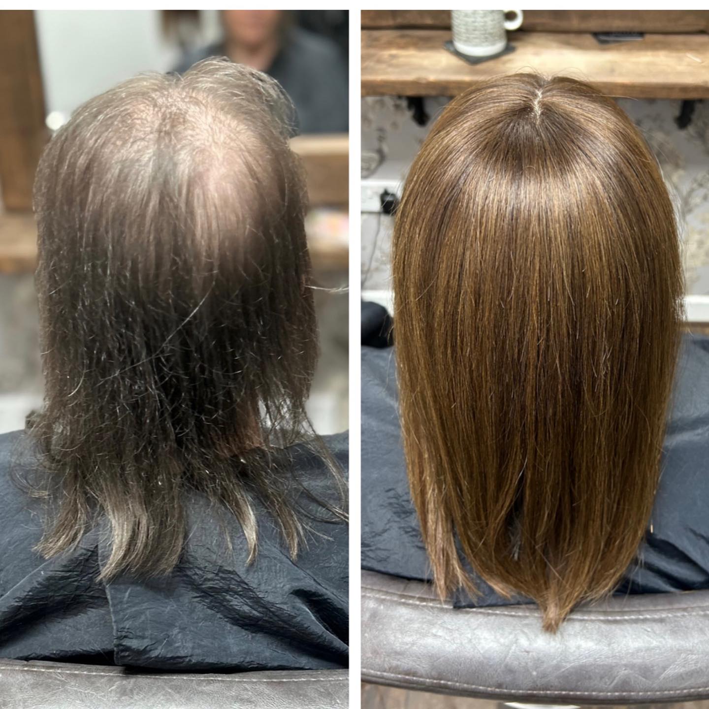 New Integration System for this lady today.
Her old one (with a few replacements toppers) was nearly 4 and a half years old ☺️
I love the colours she chooses 😍
.
.
.
.
.
#lacetopwigs #lacefrontwigs #lacewigs #wigs #lacefrontal #alopecia #areata #hairloss #hairreplacements #bespokewigs #customcolouredwigs #handmadewigs #wigbuilding #hairintegration #laceintegration #hairextensions #weave #hairlossspecialist #trichologist #trichology #hairlosssolution #hairlosssalon #hair