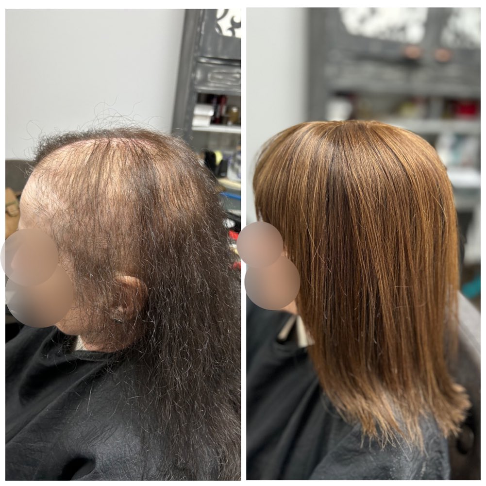 Realignment appointment for this lady yesterday. This appointment consists of taking the system off, cleaning up it up and doing any repairs if needed, i then treat the scalp and realign the system back on. 👌
.
.
.
.
#lacetopwigs #lacefrontwigs #lacewigs #wigs #lacefrontal #alopecia #areata #hairloss #hairreplacements #bespokewigs #customcolouredwigs #handmadewigs #wigbuilding #hairintegration #laceintegration #hairextensions #weave #hairlossspecialist #trichologist #trichology #hairlosssolution #hairlosssalon #hair