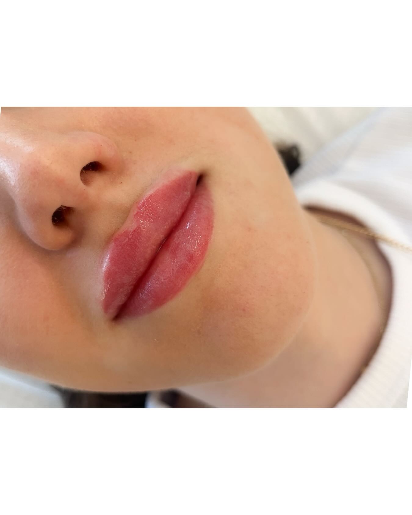 New lips for a beautiful Barbie face 👑
~Dr. Bianca Strenáčiková
#lips #aesthetic #estheticmedicine #lipsbybianca #augmentaciapier #estetickamedicina