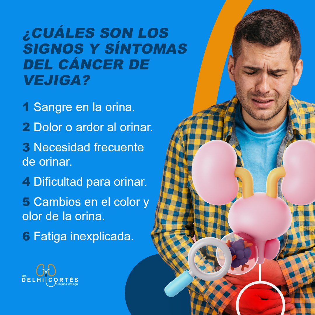 Factores de riesgo del #CáncerdeVejiga:
1️⃣ Tabaquismo.
2️⃣ Exposición a productos químicos en el trabajo.
3️⃣ Antecedentes familiares de cáncer de vejiga.
4️⃣ Infecciones crónicas del tracto urinario.
5️⃣ Edad avanzada.
La detección temprana puede marcar la diferencia. Conoce tu cuerpo y no dudes en consultar a un profesional si experimentas estos síntomas o tienes factores de riesgo. ¡Tu salud es lo más importante! 💙🩺
Agenda tu cita 👇
⚕️Doctoralia: https://www.doctoralia.com.mx/yeniseik-delhi-cortes-vazquez/urologo/san-andres-cholula
📞 Teléfono: 222 227 2713
✅ WhatsApp: 561 213 3757
Dirección:
📍 Periférico Ecológico 3507, int. 1229, Col. Emiliano Zapata, San Andrés Cholula
Horarios:
🕗Martes y jueves de 16:00 a 20:00 hrs
🕗Sábados de 10:00 a 14:00 hrs
👩⚕️ Dra. Delhi Cortés
Médico general, C.P. 09137489
Especialidad en urología, C.P. 12342044
Certificación del consejo Mexicano de Urología, 1787
#urología #urologo #médicourologo #urologa #urologocholula #urologacholula #médicocholula #urologoTlaxcala #Puebla #Tlaxcala #Cholula
