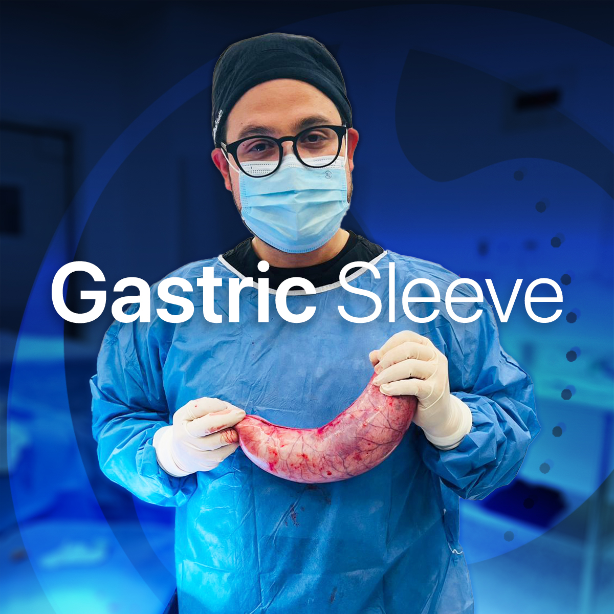 Transform Your Health and Confidence with Gastric Sleeve Surgery! 🌟
The Gastric Sleeve isn’t just a weight-loss procedure—it’s a chance to reclaim your life! By reducing your stomach size, the Gastric Sleeve helps control hunger and supports lasting weight loss, so you can focus on living the life you deserve.
🌿 What to Expect:
Safe, minimally invasive procedure
Faster recovery time, back to life in no time
Significant weight loss and health benefits, like improved heart health, blood sugar control, and joint relief
With Dr. Weight Loss Tijuana, you’re in expert hands. Our team provides all-inclusive care, so you can feel supported every step of the way.
Ready to start your journey? Book your free virtual consultation today and discover how the Gastric Sleeve can change your life! 🌟
📞 +52 332 495 9368
📞 +1 619 639 3034
🌐 www.drweightlosstijuana.com
#GastricSleeve #BariatricSurgery #WeightLossJourney #TijuanaBariatrics #TransformYourLife #DrWeightLoss #HealthFirst #LifeChangingResults