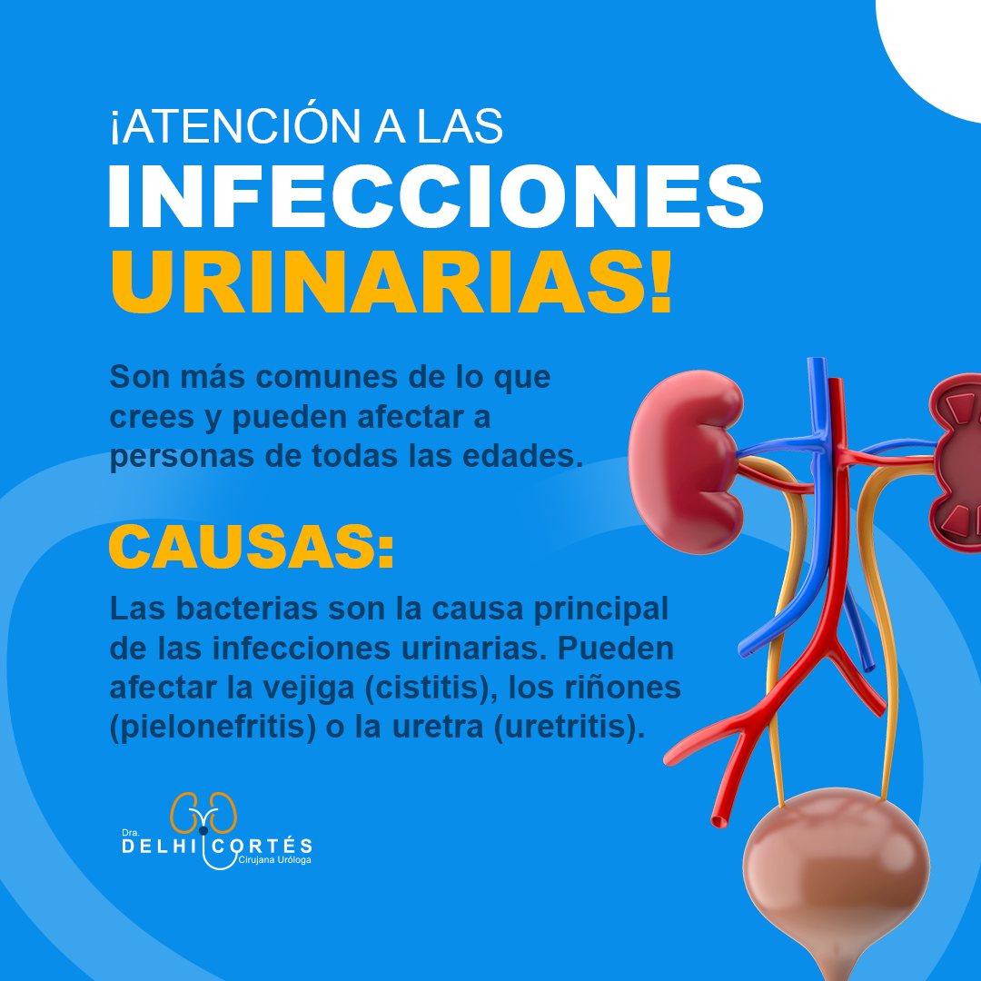 💧🚽 Algunas personas pueden experimentar infecciones urinarias recurrentes. En estos casos, es importante buscar consejo médico.
¡Tu salud urinaria es esencial!
Agenda tu cita 👇
⚕️Doctoralia: https://www.doctoralia.com.mx/yeniseik-delhi-cortes-vazquez/urologo/san-andres-cholula
📞 Teléfono: 222 227 2713
✅ WhatsApp: 561 213 3757
Dirección:
📍 Periférico Ecológico 3507, int. 1229, Col. Emiliano Zapata, San Andrés Cholula
Horarios:
🕗Martes y jueves de 16:00 a 20:00 hrs
🕗Sábados de 10:00 a 14:00 hrs
👩⚕️ Dra. Delhi Cortés
Médico general, C.P. 09137489
Especialidad en urología, C.P. 12342044
Certificación del consejo Mexicano de Urología, 1787
#urología #urologo #médicourologo #urologa #urologocholula #urologacholula #médicocholula #urologoTlaxcala #Puebla #Tlaxcala #Cholula