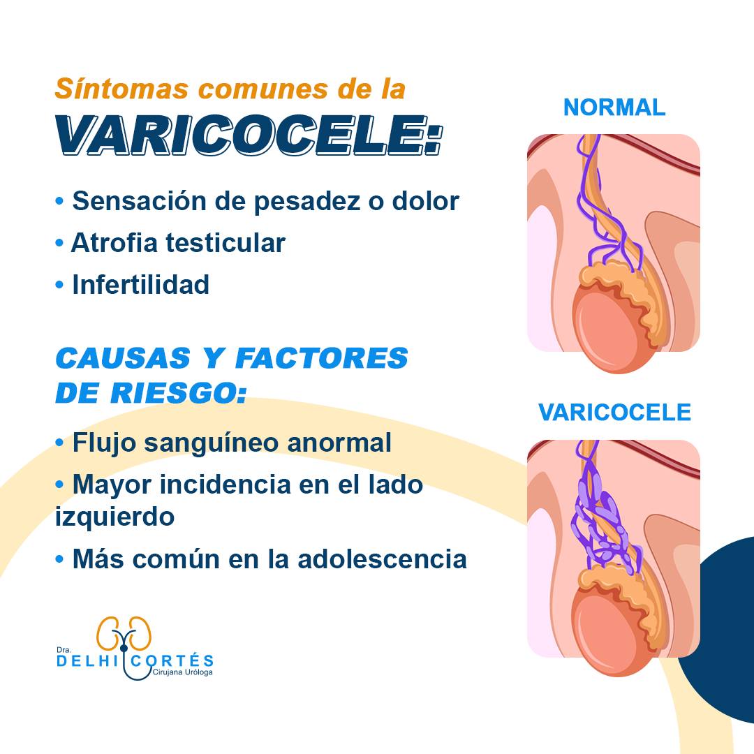 👉El varicocele es una condición médica que se caracteriza por la dilatación de las venas del cordón espermático que sostiene y nutre al testículo.
👉Estas venas dilatadas o agrandadas se conocen como varices y, en el caso del varicocele, afectan las venas que están a lo largo del cordón espermático, el cual sostiene los testículos.
🙌Es importante que cualquier persona que experimente síntomas de varicocele o que tenga preocupaciones acerca de la salud de sus testículos busque la atención de un profesional de la salud.
Agenda tu cita 👇
⚕️Doctoralia: https://www.doctoralia.com.mx/yeniseik-delhi-cortes-vazquez/urologo/san-andres-cholula
📞 Teléfono: 222 227 2713
✅ WhatsApp: 561 213 3757
Dirección:
📍 Periférico Ecológico 3507, int. 1229, Col. Emiliano Zapata, San Andrés Cholula
Horarios:
🕗Martes y jueves de 16:00 a 20:00 hrs
🕗Sábados de 10:00 a 14:00 hrs
👩⚕️ Dra. Delhi Cortés
Médico general, C.P. 09137489
Especialidad en urología, C.P. 12342044
Certificación del consejo Mexicano de Urología, 1787
#urología #urologo #médicourologo #urologa #urologocholula #urologacholula #médicocholula #urologoTlaxcala #Puebla #Tlaxcala #Cholula
