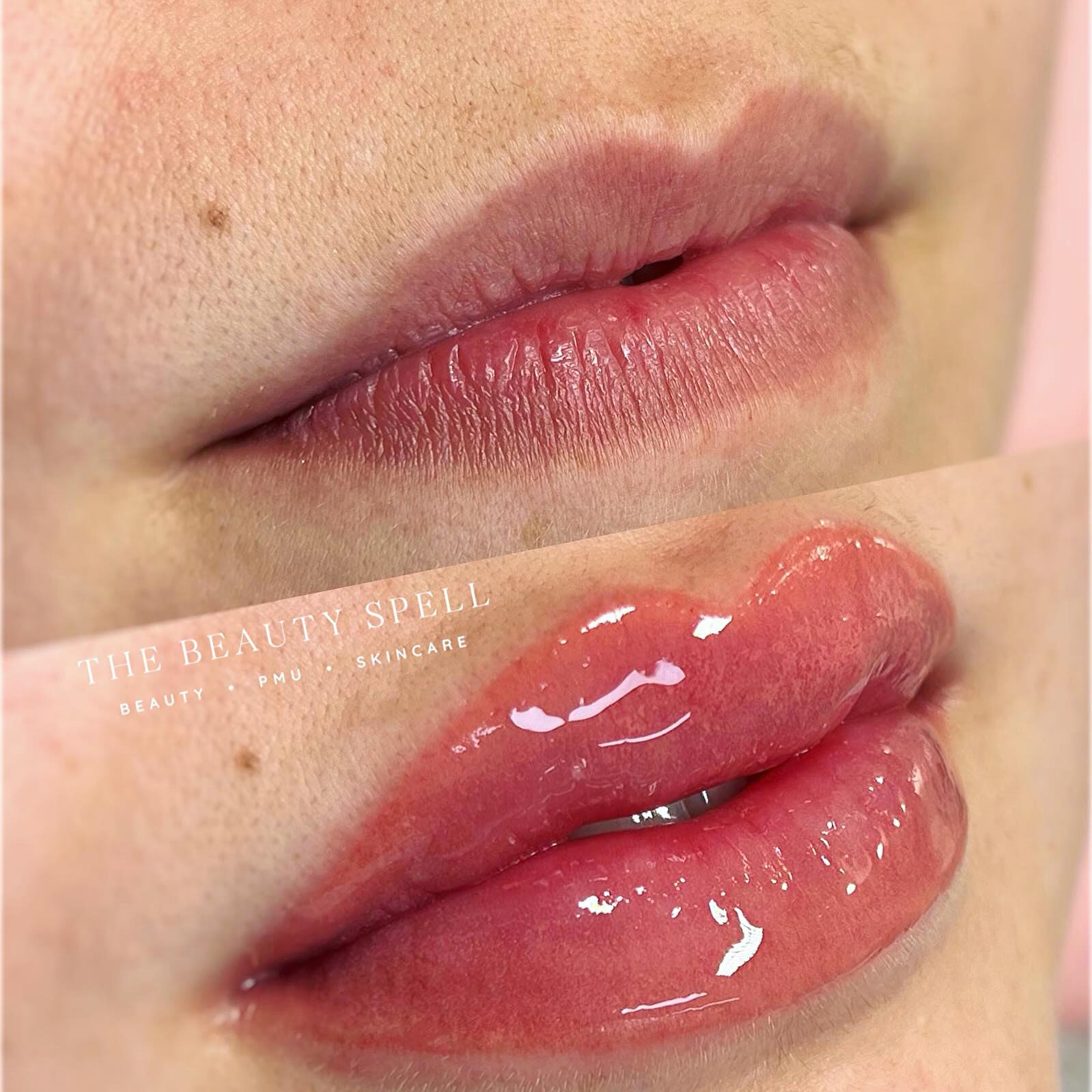 LIPBLUSH👄
Deze beauty had al prachtige lippen van haar zelf alleen miste pigment in haar mondhoeken. Dus we hebben voor een natuurlijk kleur gekozen puur om haar natuurlijk vorm meer naar voren te brengen.✨
@phiacademy_schora
@branko_babic_phiacademy @ayaahassanii
#lipblush #lippigmentation #pmulips #pmu #lippigmentatie #colorlips #permanentmakeup #groningen #happycustomer #phicontourlips #phicontour #poppinglips #neutralizing #phiacademy
