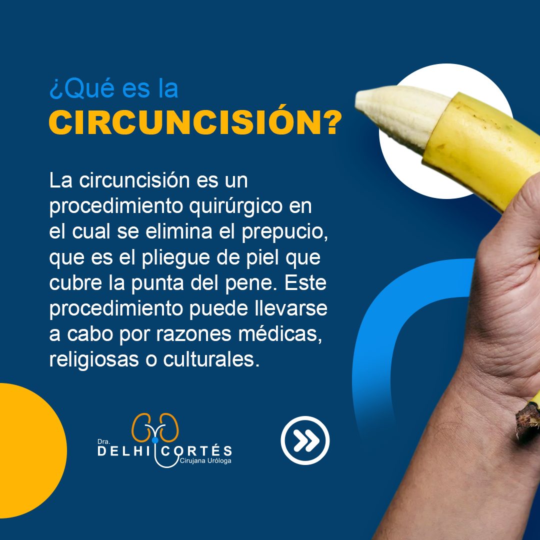 🙌Es importante destacar que la decisión de realizar la circuncisión suele ser personal y depende de factores médicos, religiosos y culturales.
👉Los padres deben discutir con los profesionales de la salud y tomar una decisión informada.
👉En muchos lugares, la circuncisión es un procedimiento opcional y no es universalmente recomendada desde el punto de vista médico, ya que los beneficios y riesgos deben ser considerados caso por caso.
Agenda tu cita 👇
⚕️Doctoralia: https://www.doctoralia.com.mx/yeniseik-delhi-cortes-vazquez/urologo/san-andres-cholula
📞 Teléfono: 222 227 2713
✅ WhatsApp: 561 213 3757
Dirección:
📍 Periférico Ecológico 3507, int. 1229, Col. Emiliano Zapata, San Andrés Cholula
Horarios:
🕗Martes y jueves de 16:00 a 20:00 hrs
🕗Sábados de 10:00 a 14:00 hrs
👩⚕️ Dra. Delhi Cortés
Médico general, C.P. 09137489
Especialidad en urología, C.P. 12342044
Certificación del consejo Mexicano de Urología, 1787
#urología #urologo #médicourologo #urologa #urologocholula #urologacholula #médicocholula #urologoTlaxcala #Puebla #Tlaxcala #Cholula
