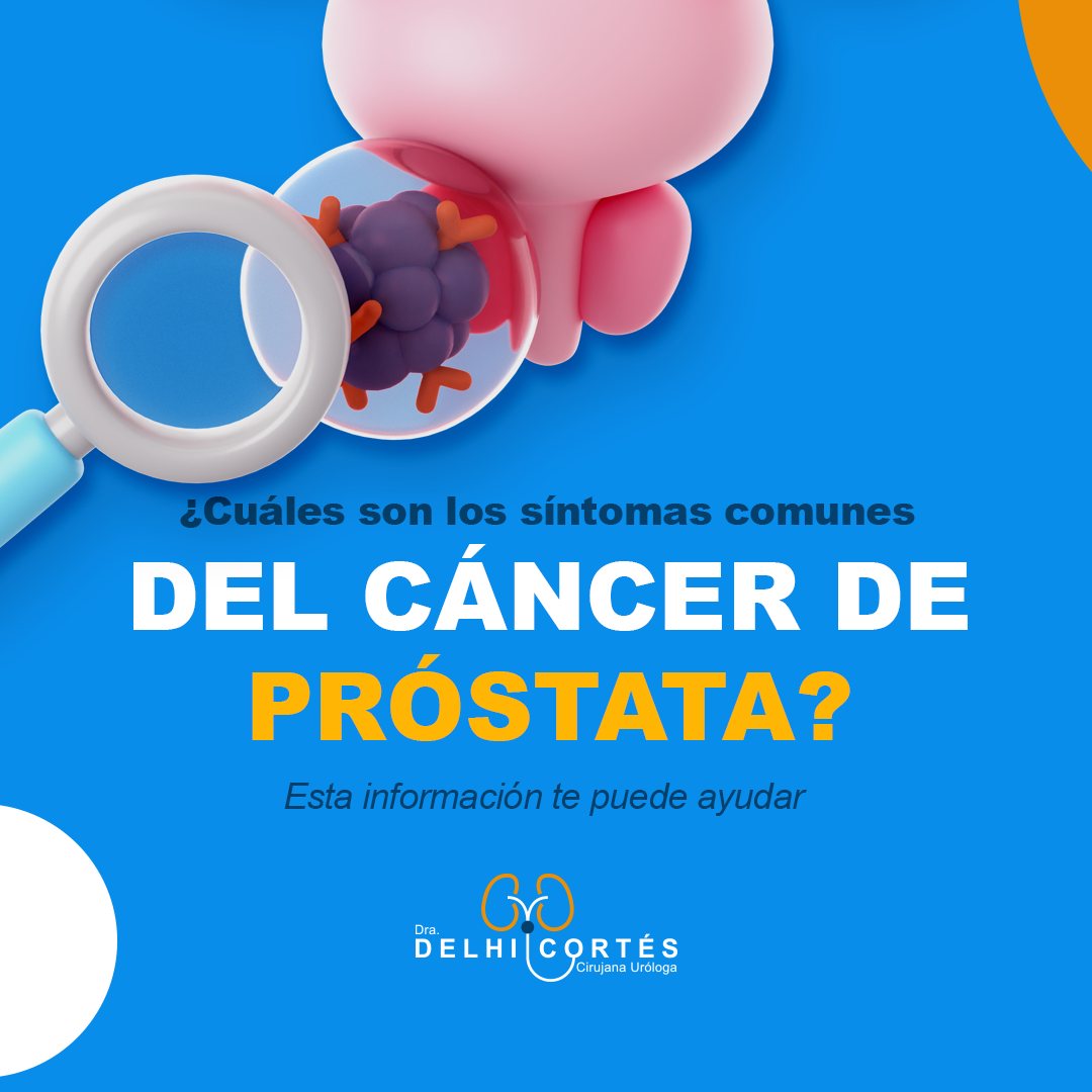 👉El cáncer de próstata es un tipo de cáncer que se desarrolla en la glándula prostática, una pequeña glándula ubicada debajo de la vejiga y delante del recto en los hombres.
👉La próstata produce parte del líquido seminal que transporta y nutre a los espermatozoides.
🙌En las etapas tempranas, el cáncer de próstata puede no causar síntomas. Sin embargo, a medida que progresa, algunos síntomas pueden incluir:
✅Dificultad para orinar.
✅Necesidad frecuente de orinar, especialmente por la noche.
✅Dolor o ardor durante la micción.
✅Sangre en la orina o semen.
✅Dolor en la parte baja de la espalda, caderas o muslos.
🙌Es crucial que los hombres discutan con su médico las opciones de detección y los factores de riesgo, especialmente a medida que envejecen.
Agenda tu cita 👇
⚕️Doctoralia: https://www.doctoralia.com.mx/yeniseik-delhi-cortes-vazquez/urologo/san-andres-cholula
📞 Teléfono: 222 227 2713
✅ WhatsApp: 561 213 3757
Dirección:
📍 Periférico Ecológico 3507, int. 1229, Col. Emiliano Zapata, San Andrés Cholula
Horarios:
🕗Martes y jueves de 16:00 a 20:00 hrs
🕗Sábados de 10:00 a 14:00 hrs
👩⚕️ Dra. Delhi Cortés
Médico general, C.P. 09137489
Especialidad en urología, C.P. 12342044
Certificación del consejo Mexicano de Urología, 1787
#urología #urologo #médicourologo #urologa #urologocholula #urologacholula #médicocholula #urologoTlaxcala #Puebla #Tlaxcala #Cholula
