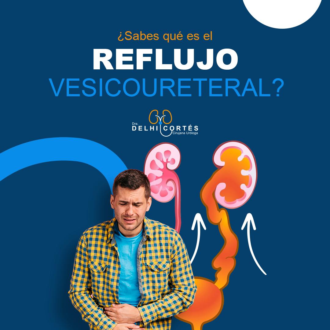 👉El reflujo vesicoureteral (RVU) es una condición médica que afecta el sistema urinario, específicamente la conexión entre la vejiga y los uréteres. Los uréteres son los conductos que transportan la orina desde los riñones hasta la vejiga.
👉En condiciones normales, cuando la vejiga se contrae para expulsar la orina, los músculos alrededor de la conexión entre los uréteres y la vejiga se cierran, evitando que la orina fluya hacia atrás hacia los riñones.
🙌Es importante destacar que el reflujo vesicoureteral puede tener implicaciones a largo plazo en la salud renal, especialmente si no se trata adecuadamente. Por lo tanto, el diagnóstico y tratamiento oportunos son fundamentales para prevenir complicaciones y preservar la función renal.
Agenda tu cita 👇
⚕️Doctoralia: https://www.doctoralia.com.mx/yeniseik-delhi-cortes-vazquez/urologo/san-andres-cholula
📞 Teléfono: 222 227 2713
✅ WhatsApp: 561 213 3757
Dirección:
📍 Periférico Ecológico 3507, int. 1229, Col. Emiliano Zapata, San Andrés Cholula
Horarios:
🕗Martes y jueves de 16:00 a 20:00 hrs
🕗Sábados de 10:00 a 14:00 hrs
👩⚕️ Dra. Delhi Cortés
Médico general, C.P. 09137489
Especialidad en urología, C.P. 12342044
Certificación del consejo Mexicano de Urología, 1787
#urología #urologo #médicourologo #urologa #urologocholula #urologacholula #médicocholula #urologoTlaxcala #Puebla #Tlaxcala #Cholula