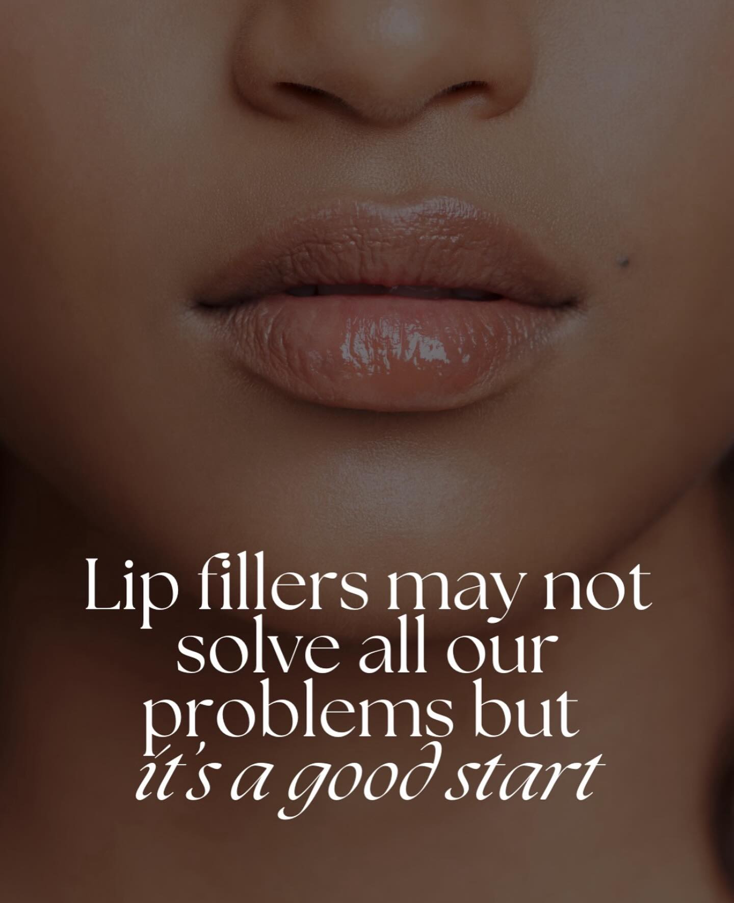 Looking for that extra spark in your self-care journey? Lip fillers are here to deliver! Enhance your natural beauty and embrace a newfound confidence.
Don’t wait - let your dream lips come to life! Book NOW at www.winkswhims.com
.
.
.
#yyc #calgary #edmonton #okotoks #vancouver #yycmicroblading #yyceyebrows #youtube #microblading #eyebrows #brows #eyebrowgame #yyclove #calgarymicroblading #calgaryeyebrowtattoo #browtattoo #eyebrowtattoo #makeuptutorial #celebritybrows #eyebrowsonpoint #yycbeauty #yycfashion #yycfitness #yycstyle #sephora #archaddicts #browsworldwide #hudabeauty #anastasiabeverlyhills #makeuptutorial
