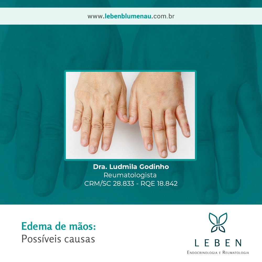 Mãos inchadas sem uma razão aparente exigem atenção e investigação para afastar causas graves. Pode ser algo passageiro e leve, mas em alguns casos geram um grande desconforto e dores, de modo a prejudicar a qualidade de vida do paciente.
Entre as possibilidades que podem causar o inchaço das mãos podemos listar:
✋ Má circulação (alteração dos vasos, da coagulação ou de causa cardíaca);
✋ Altas temperaturas;
✋ Hipertensão;
✋ Excesso de sal no corpo;
✋ Excesso de exercícios;
✋ Tendinites;
✋ Artrites;
✋ Alterações hormonais;
✋ Doenças reumáticas;
✋ Outras causas, como urticária ao frio e eritema pérnio (perniose).
Em situações persistentes é fundamental buscar atendimento médico para um diagnóstico preciso.
-------------------------------------
Clínica Leben
Whatsapp: (47) 99951-1836
www.lebenblumenau.com.br
-------------------------------------
#clinicaleben #reumatologia #reumatologista #endocrinologia #endocrinologista #metabologia #blumenau