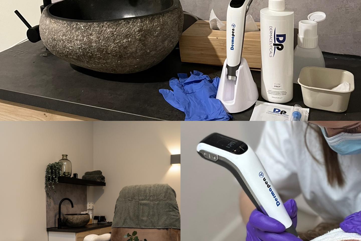 Dit is het perfecte moment om een intensieve en effectieve behandeling te boeken!
Microneedling:
* Stimuleert de collageen en elastine aanmaak
* verminderd rimpels en fijne lijntjes
* maakt je huid strakker
* verminderd littekens en grove poriën
* verminderd couperose en pigmentvlekken
* geeft een prachtige gezonde glow!
www.schoonheidssalonwilmameins.nl
#schoonheidssalonwilmameins #centrumveendam #venvanveendam #dermapen #microneedling #liefzijnvoorjehuid