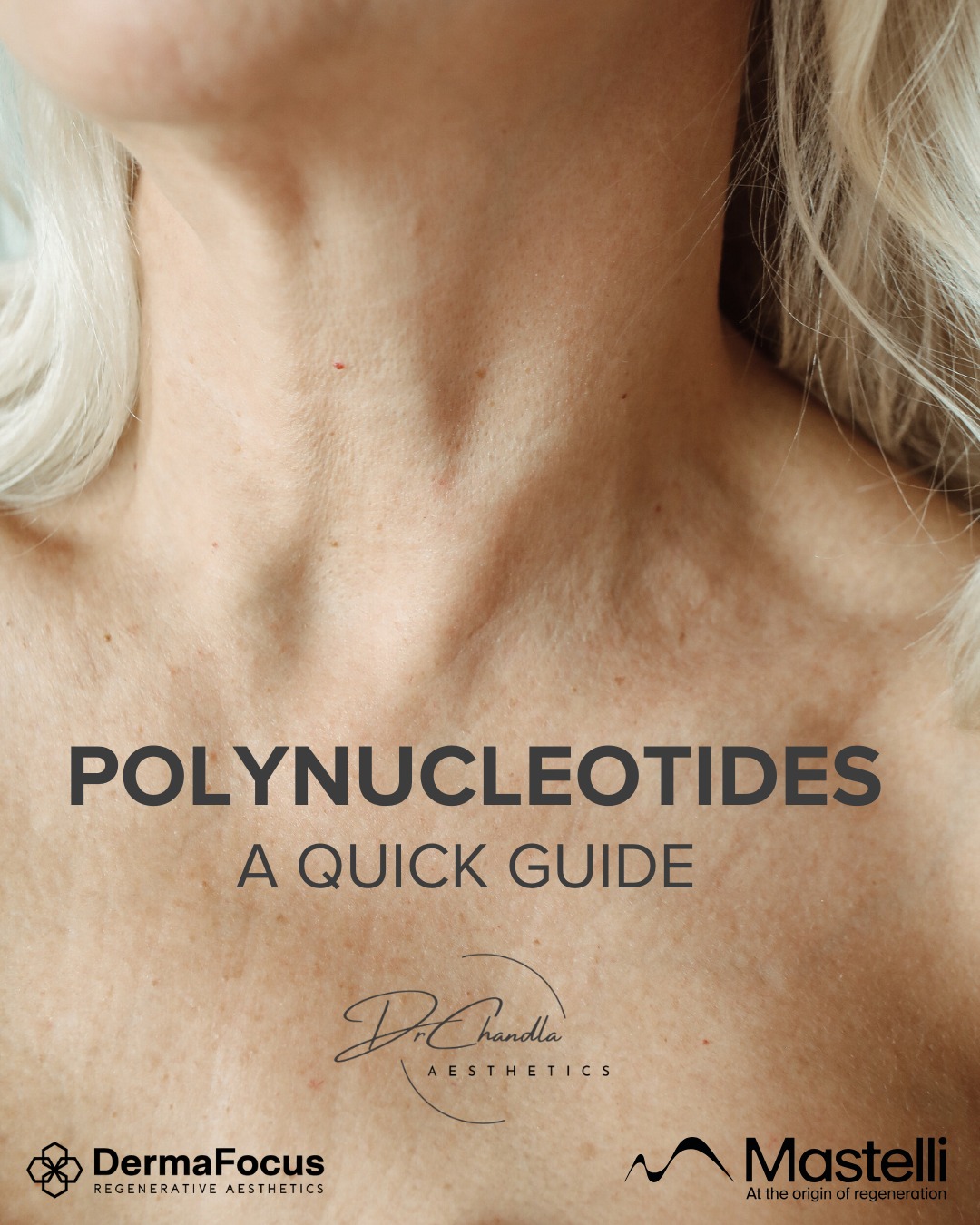 Polynucleotides: Unlock the Power of Regeneration
Have you heard of polynucleotides? This revolutionary treatment is taking the aesthetic world by storm, and for good reason! See our quick guide for all you need to know!
What are Polynucleotides? They're natural DNA fragments that stimulate your skin's own fibroblasts, leading to increased collagen and elastin production.
Benefits:
- Intense hydration and improved skin texture.
- Reduced fine lines and wrinkles.
- Enhanced skin elasticity and firmness.
- Improved skin tone and radiance.
- Treats under eye darkness and crepiness.
How it Works: Polynucleotides are an injectable treatment that works to stimulate the skin's own repair processes, promoting cellular regeneration. A typical course of treatment is 3 sessions carried out 3-4 weeks apart initially followed by a single treatment every 6 months.
Results: Expect natural-looking, long-lasting results that improve over time.
Ready to revitalise your skin from the inside out? Polynucleotides can help you achieve a youthful, radiant complexion.
Book your consultation today to learn more!
Dr Chandla Aesthetics is a Doctor Led Medical Aesthetics Clinic.
📞 07930674092
🌐 www.drchandlaaesthetics.co.uk
#Polynucleotides #PolynucleotideTreatment #PNtreatment #SkinRegeneration #CellularRegeneration #AntiAging #SkinRejuvenation #GlowingSkin #SkinHealth #CollagenBoost #HydratedSkin #SkinTexture #FineLinesAndWrinkles #AestheticTreatments #MedicalAesthetics #AestheticMedicine #UndereyeTreatment #aestheticsbirmingham #aestheticssolihull #aestheticshallgreen #aestheticswestbrom #Mastelli #dermafocus #aestheticsdoctorsandwell #plinest #plinesteye #Newest