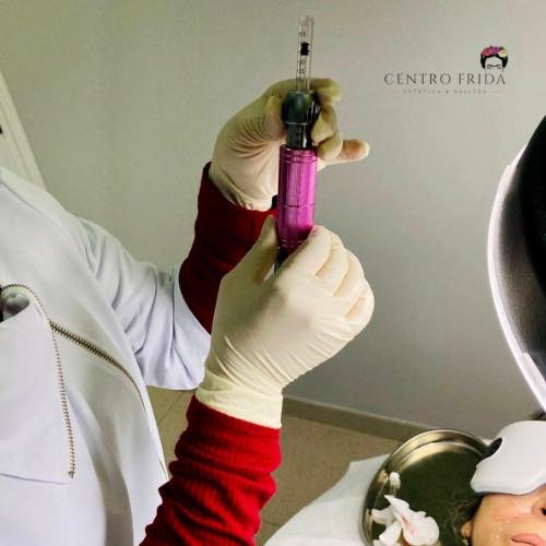 ¿Te preocupa la apariencia de los surcos nasogenianos pero temes el procedimiento con agujas?
En centro Frida Tenemos la solución perfecta para ti! 😉
El relleno de ácido hialurónico sin agujas es la técnica revolucionaria que te permitirá rejuvenecer tu rostro de forma indolora y sin complicaciones.
Recupera la juventud y la frescura de tu rostro de forma segura y sin dolor con el relleno de ácido hialurónico en surcos nasogenianos sin agujas.
Contacta con nosotros para conocer más sobre esta técnica 😊
Centro Frida 🌸
Estética & Belleza
📲624252194