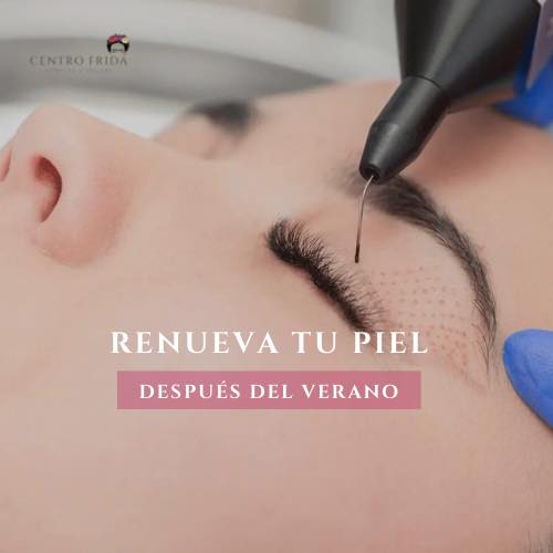Después de unas merecidas vacaciones, regresamos con más energía que nunca y una oferta imperdible para renovar tu piel y lucir radiante tras el verano 🌟
✨ ¡10% de descuento en todos los tratamientos de Plasmapen! ✨
Es el momento perfecto para mimarte y darle a tu piel el cuidado que se merece. No dejes pasar esta oportunidad única de revitalizar tu belleza con la tecnología más avanzada.
📅 Promoción válida hasta el 30 de septiembre
📍 Visítanos en Centro Frida y disfruta de este descuento especial.
¡Te esperamos para que te veas y sientas espectacular!
Centro Frida
Estética & Belleza 🌸
📲 624252194
••••••••••••••••••••••••
#CentroFrida #Plasmapen #DescuentoEspecial #BellezaPostVerano #CuidadoDeLaPiel #Estética