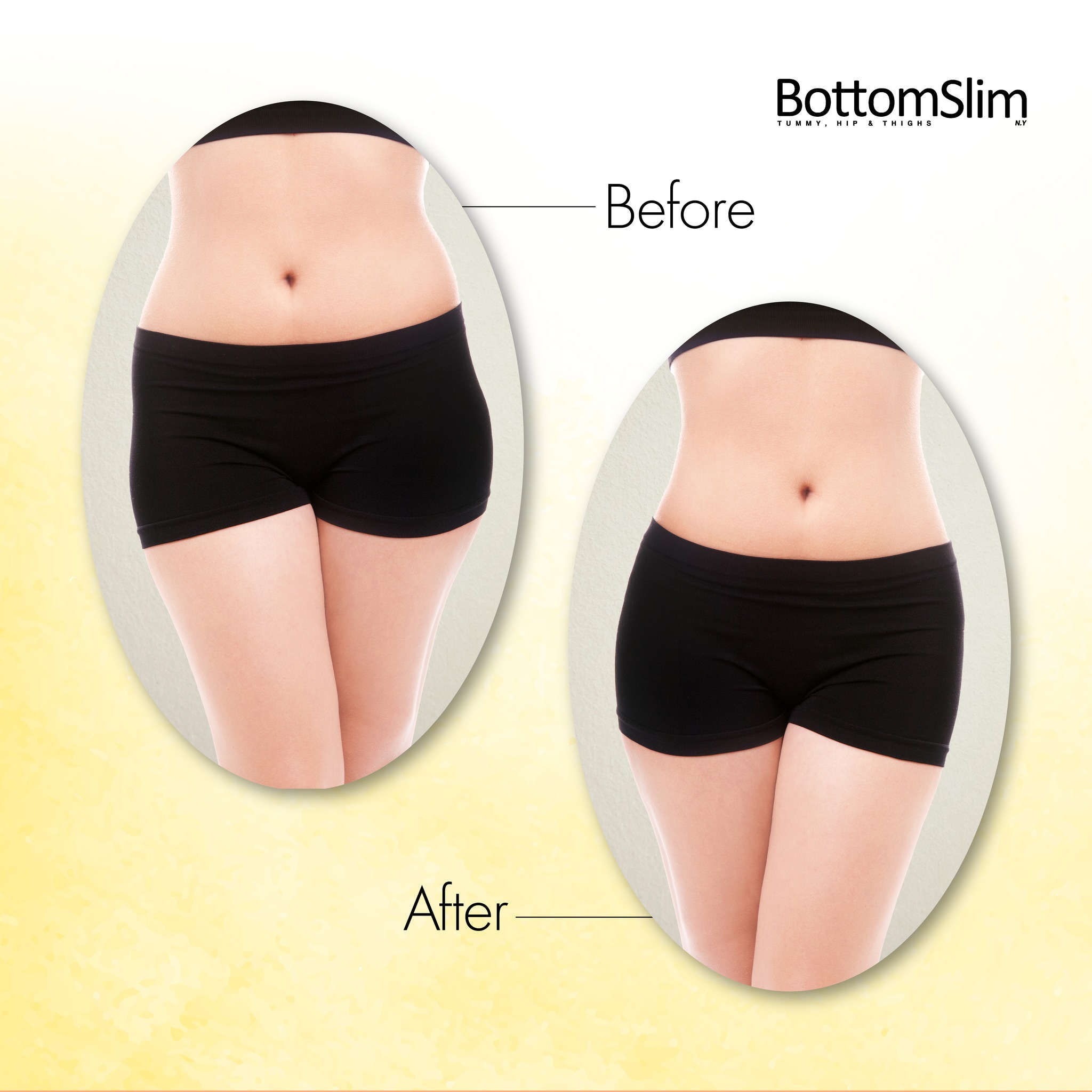 Transformations are truly inspiring! Our customers have experienced significant slimming results, leaving them feeling more confident and happy😊
The difference is not just visible but life-changing. Imagine fitting into your favorite outfits👗again with ease and joy!
BottomSlim's approach is designed to bring out the best version of you❤️🔥
#BottomSlim #slimming #slim #beauty #treatment #bodytoning #bodyconfidence #Bodygoals #body #bodyshape #cellulite #unevenskin #exercise #slimcontour
