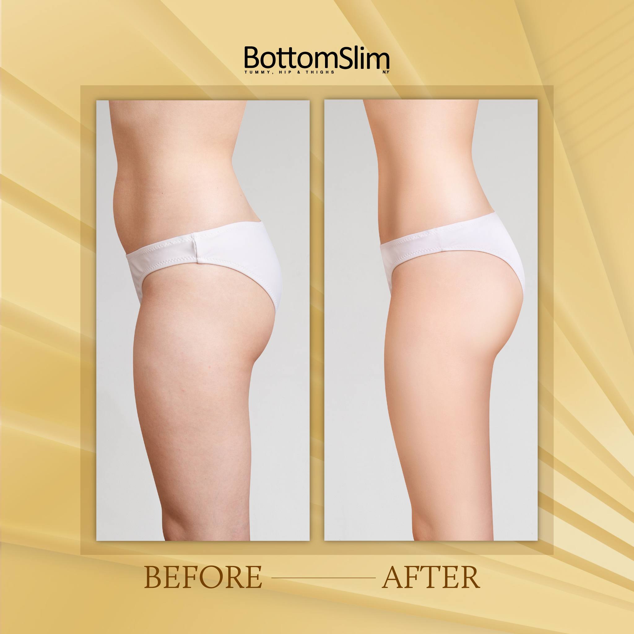 ✨ Unbelievable Transformations! ✨ Witness these stunning before-and-after results that showcase the incredible power of bottom-slimming.
Each journey reveals a dramatic change, with toned, lifted, and beautifully contoured silhouettes. Imagine the confidence and joy that come with these remarkable transformations.
Ready to see your own transformation? Start your journey today and achieve your dreams with BottomSlim
#BottomSlim #slimming #slim #beauty #treatment #bodytoning #bodyconfidence #Bodygoals #body #bodyshape #cellulite #unevenskin #exercise #slimcontour
