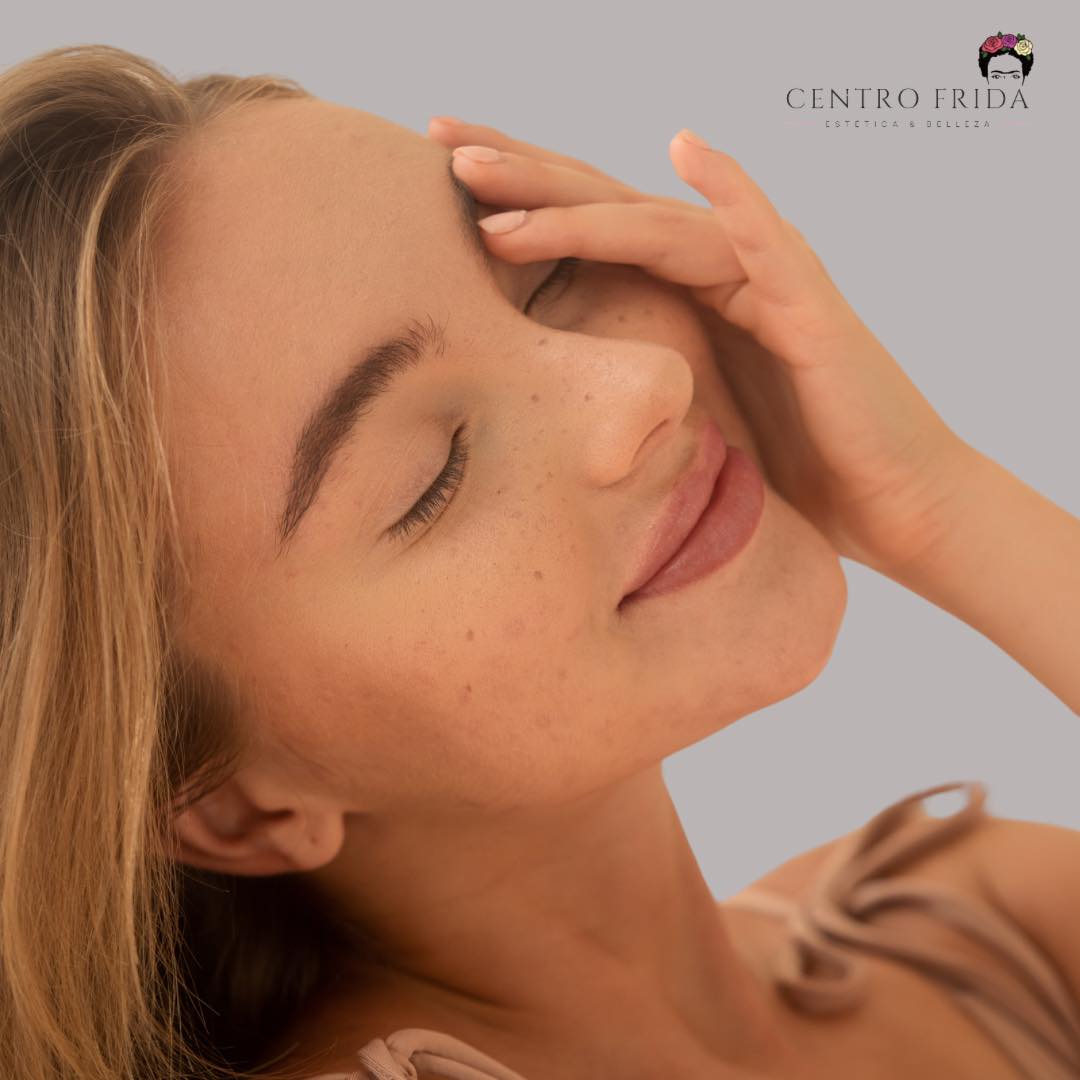 ¡Atención a todas las interesad@s! 🌟
En Centro Frida, estamos en la búsqueda de modelos para nuestros exclusivos tratamientos de PLASMAPEN y microblading. Si deseas experimentar un cambio en tu apariencia y mejorar tu autoestima, esta es tu oportunidad.
¿Qué es el PLASMAPEN?
El PLASMAPEN es una innovadora técnica que utiliza plasma para rejuvenecer la piel. Este tratamiento es ideal para:
✔️Reducir arrugas y líneas de expresión.
✔️Mejorar la textura de la piel.
✔️Mejorar la flacidez
✔️Tratar manchas y cicatrices.
¿Y el microblading?
El microblading es una técnica semipermanente que permite definir y dar forma a las cejas, logrando un aspecto natural. Si sueñas con unas cejas perfectas y bien definidas, ¡este tratamiento es para ti!
Al ser modelo en nuestros tratamientos, tendrás la oportunidad de beneficiarte de estos procedimientos d a un costo reducido, a cambio de permitirnos documentar el proceso y los resultados.
Requisitos:
✨Mayor de 18 años.
✨Disposición para ser parte del proceso.
✨Interés en mejorar tu estética.
Si estás interesad@ en participar, no dudes en ponerte en contacto con nosotros a través de nuestras redes sociales o directamente en el Centro Frida.
¡Te esperamos para transformar tu belleza! 💫
Centro Frida
Estética & Belleza 🌸
📲 624252194
••••••••••••••••••••••••
#CentroFrida #Plasmapen #DescuentoEspecial #BellezaPostVerano #CuidadoDeLaPiel #esteticamadrid