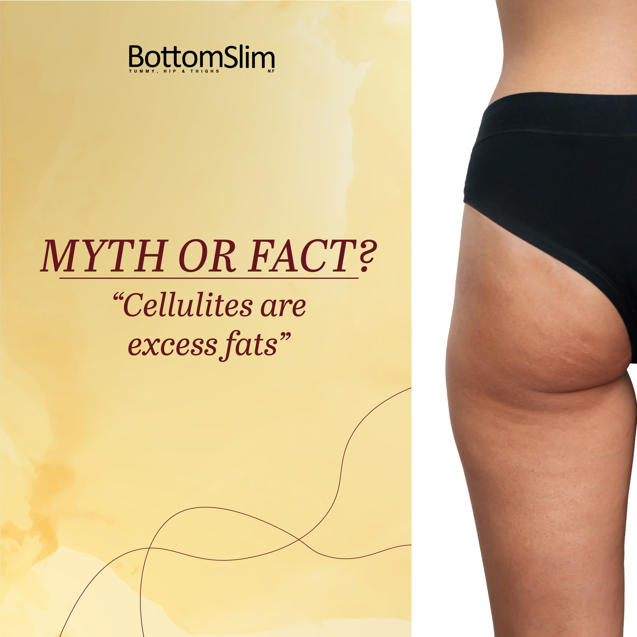 "Cellulite is excess fat" is a actually myth!
Forget the idea that cellulite equals too much fat! While fat plays a role, it's not the main culprit behind the dimpling. It's actually the connective tissue under your skin that weakens and causes the fat to push through, creating that bumpy texture.
If you have concerns about cellulite, do not worry as BottomSlim New York will be your guide.
#BottomSlim #slimming #slim #beauty #treatment #bodytoning #bodyconfidence #Bodygoals #body #bodyshape #cellulite #unevenskin #exercise #slimcontour