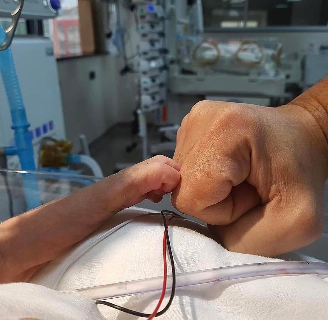 This little newborn is tightly attached to life after a open heart surgery do true heros aren't measured by their physical size, but by their inner strength to persevere despite overwhelming challenges.
This tiny newborn has shown remarkable resilience after undergoing open-heart surgery to correct a rare congenital heart condition called Interrupted Aortic Arch. This condition involves a separation or absence between the ascending and descending aorta, sometimes connected by a fibrous band.
Often, there are additional issues like a large ventricular septal defect and patent ductus arteriosus. Interrupted Aortic Arch results from improper development of the aortic arch system during fetal development, usually between the fifth and seventh week.
Despite these formidable obstacles, she has defied the odds and deserves a heartfelt fist bump
Credit: Surgerycases
#tactical #save #human #trauma #training #teaching #learning #community #medical #bethechange #life #vaemstg #emt #firefighter #fire #paramedic #ems #reels #school #education #virginia #group #youtube #knowledge #instagram #trending #facebook